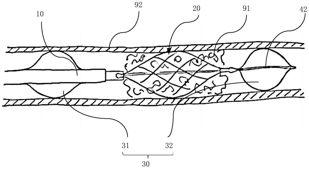 Blood vessel thrombus extraction device