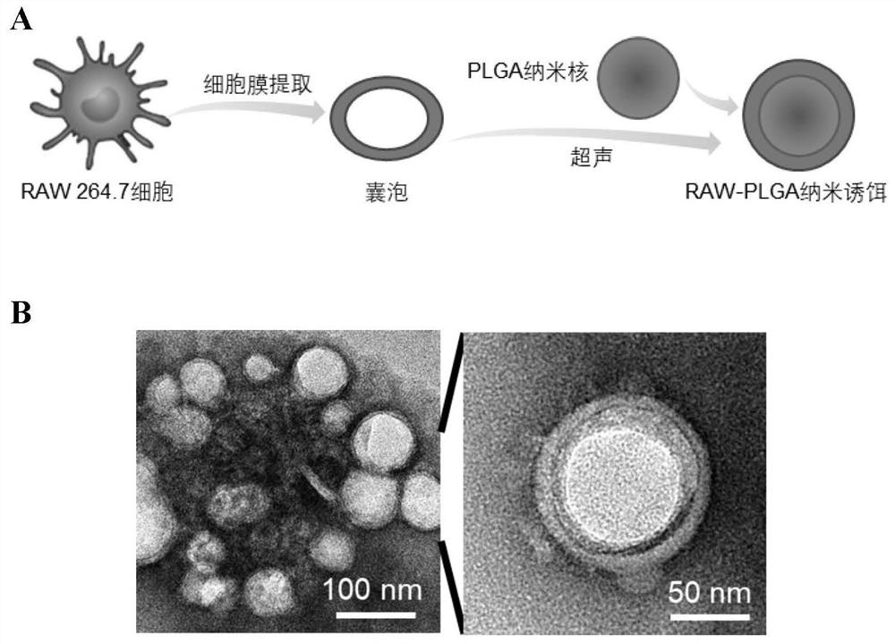Cell membrane coated nano bait for removing RANKL, preparation and application thereof