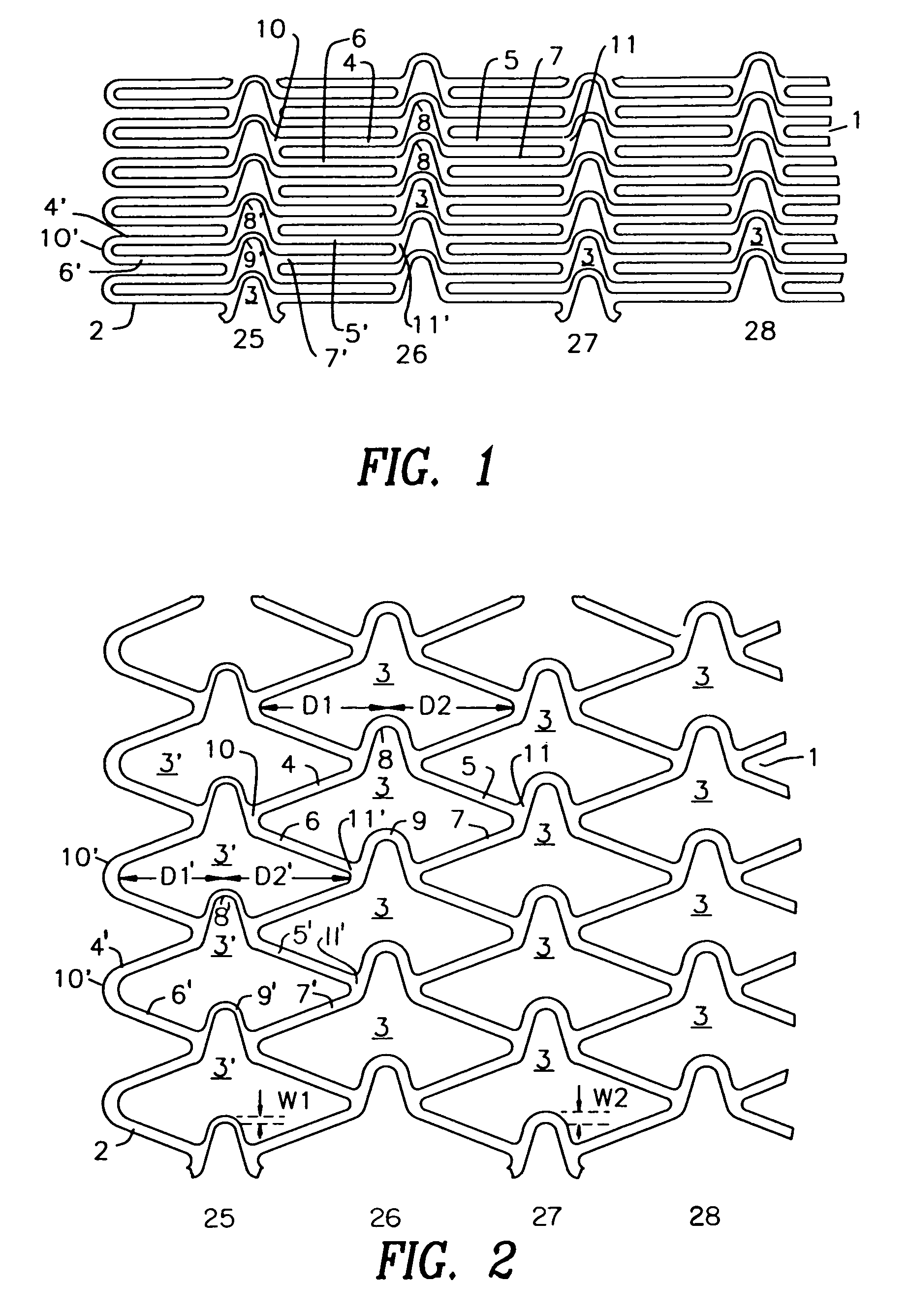 Stent with variable features to optimize support and method of making such stent