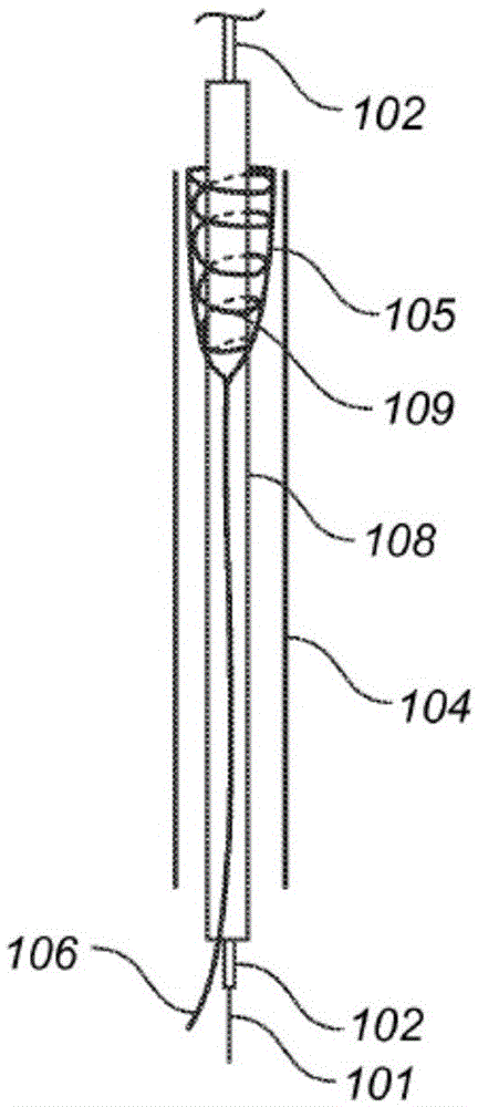 Device to percutaneously treatment of heart valve embolization