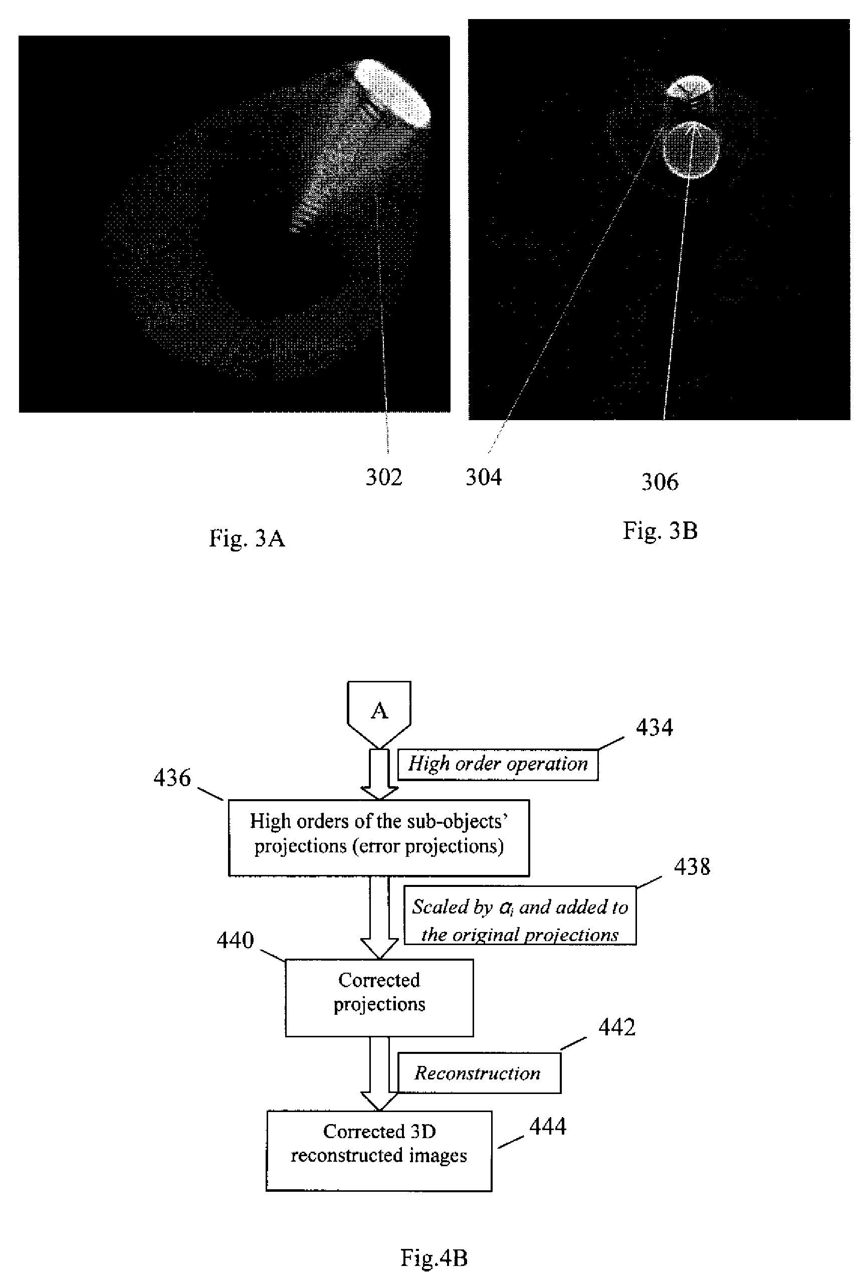 Method and apparatus for 3D metal and high-density artifact correction for cone-beam and fan-beam CT imaging