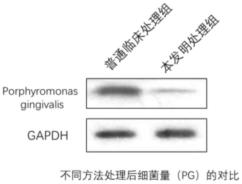 A tooth root surface treatment agent