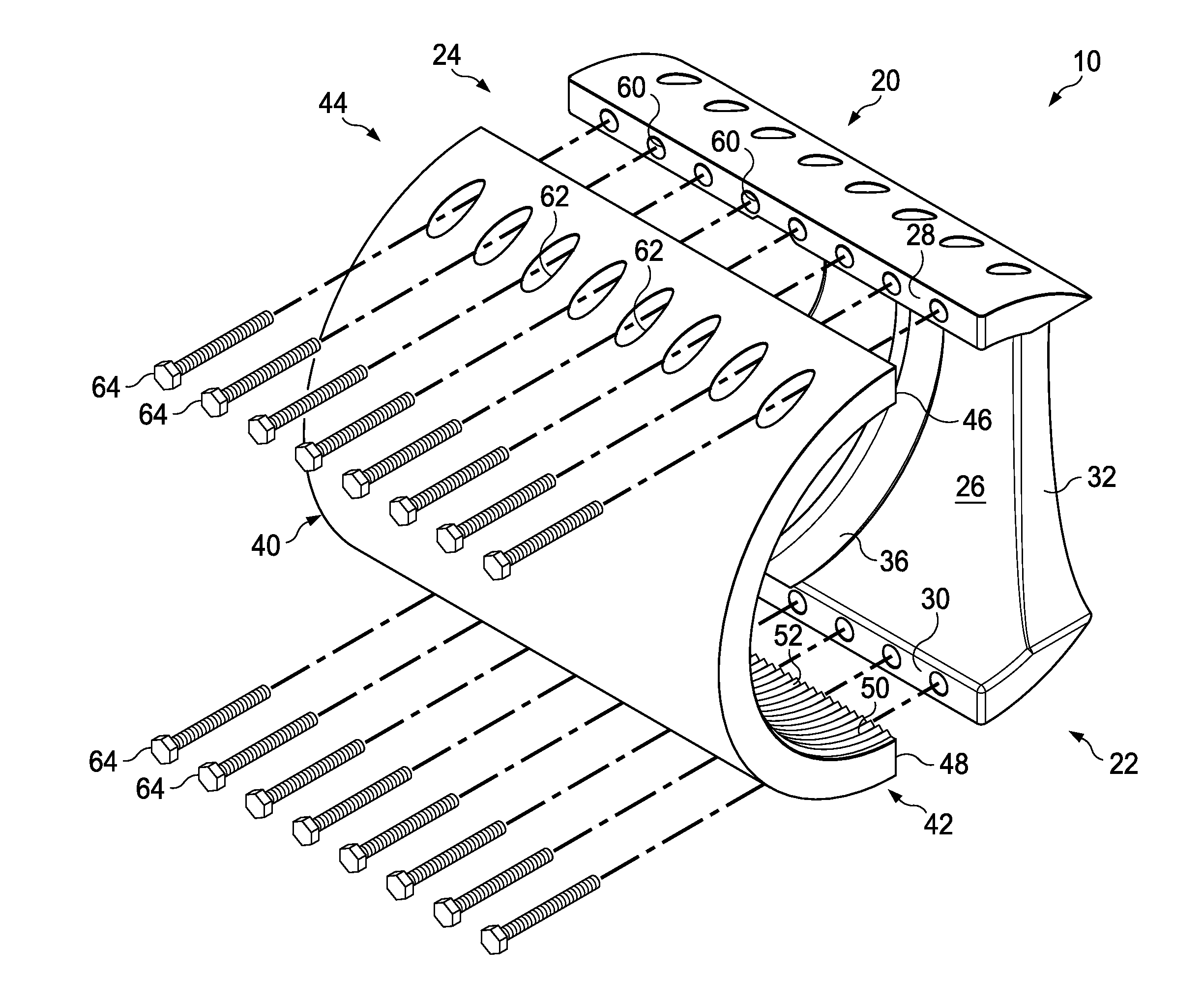 Clamp suitable for increasing the fatigue life of the butt welds of a pipe pressure vessel which is subsequently bent