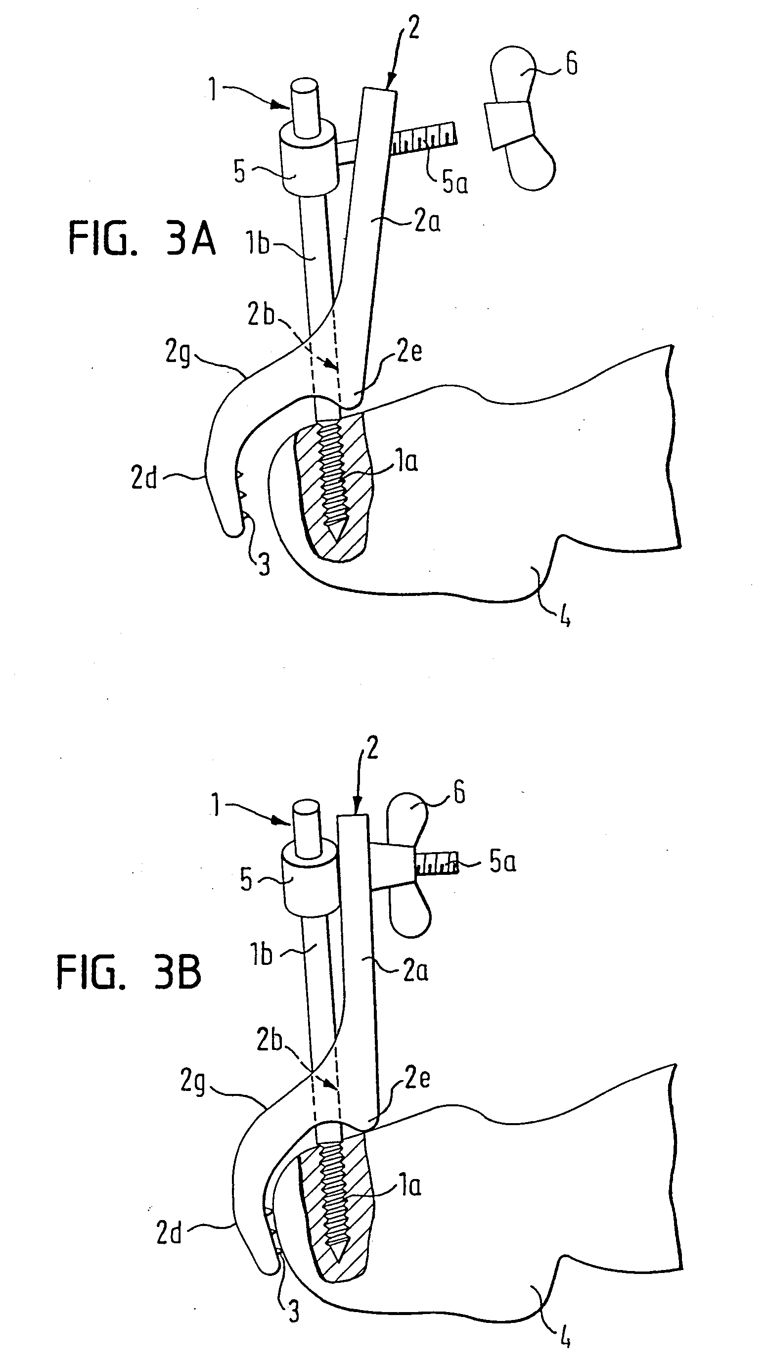 Device for fixing a reference element