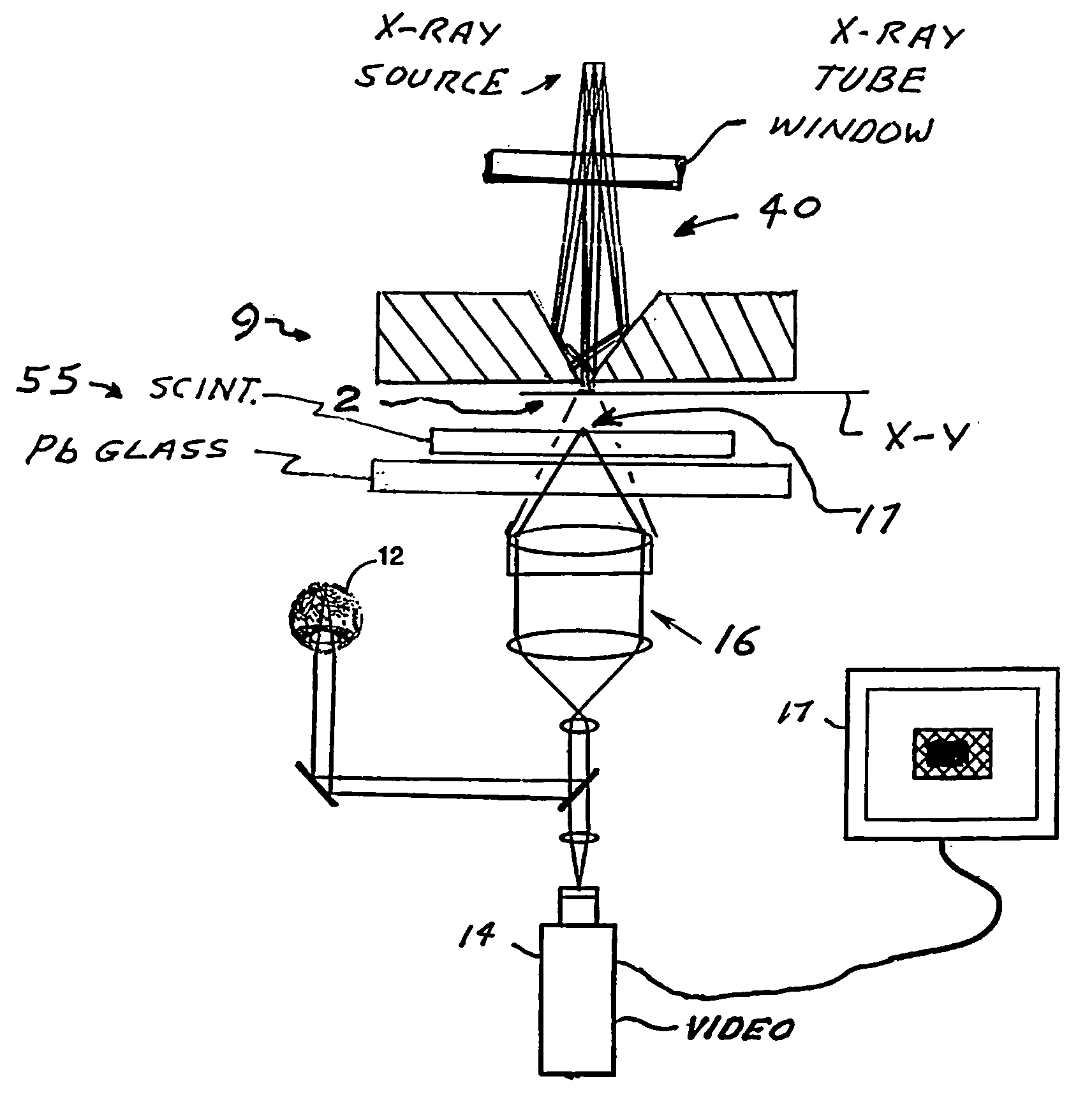 Scintillator-based micro-radiographic imaging device