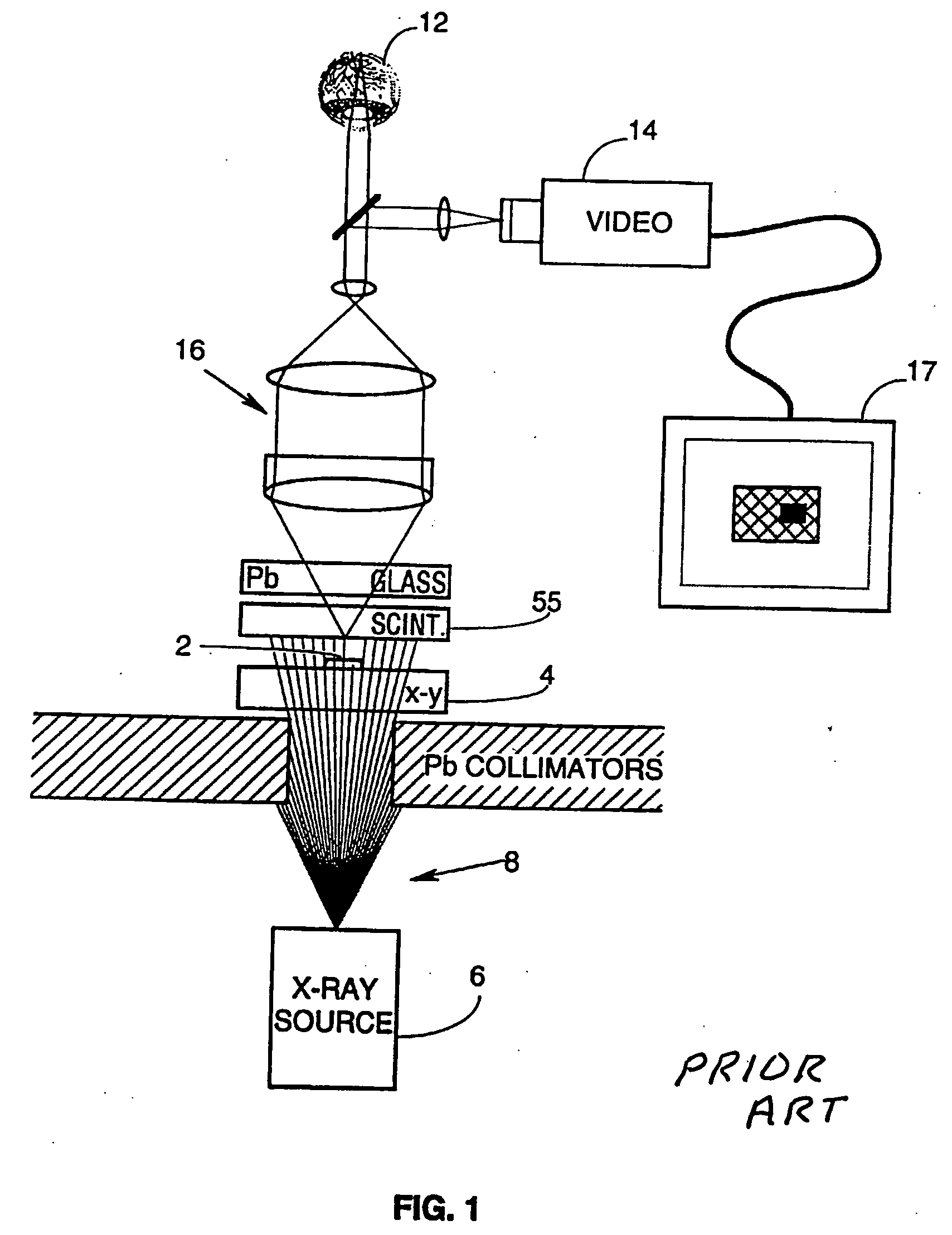 Scintillator-based micro-radiographic imaging device