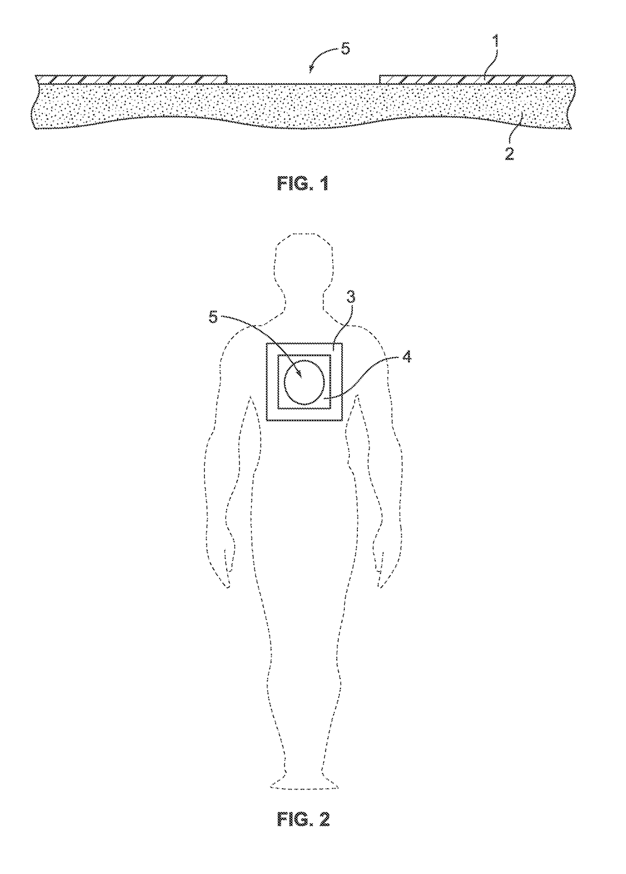 Surgical Drape With Selectively Detachable Barrier