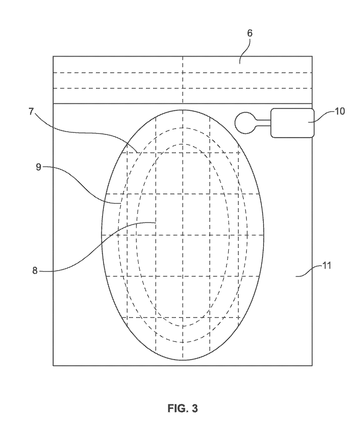 Surgical Drape With Selectively Detachable Barrier