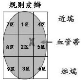 Nursing monitoring equipment, system, method, product and server after skin flap transplantation