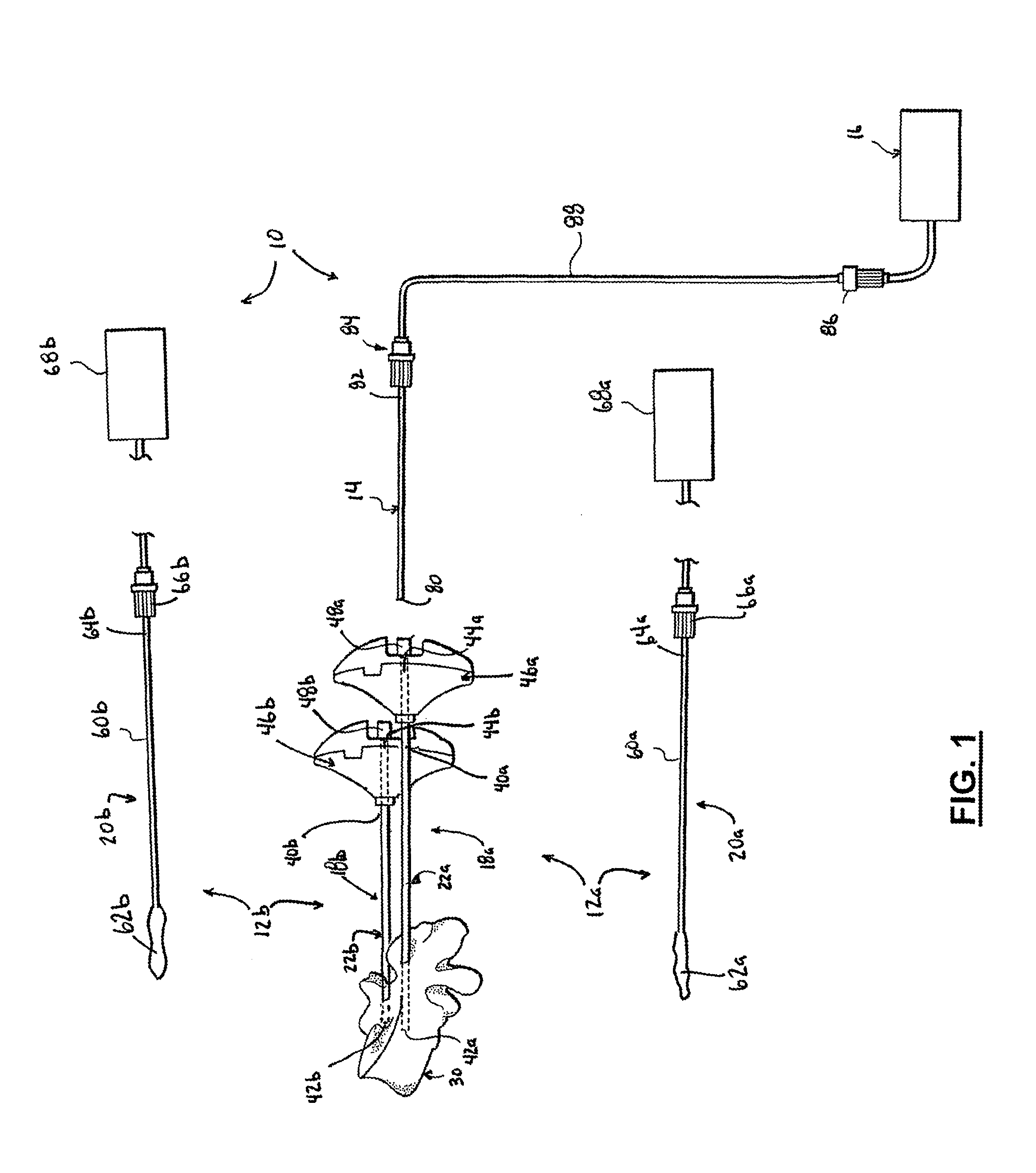 Apparatus and method for stylet-guided vertebral augmentation