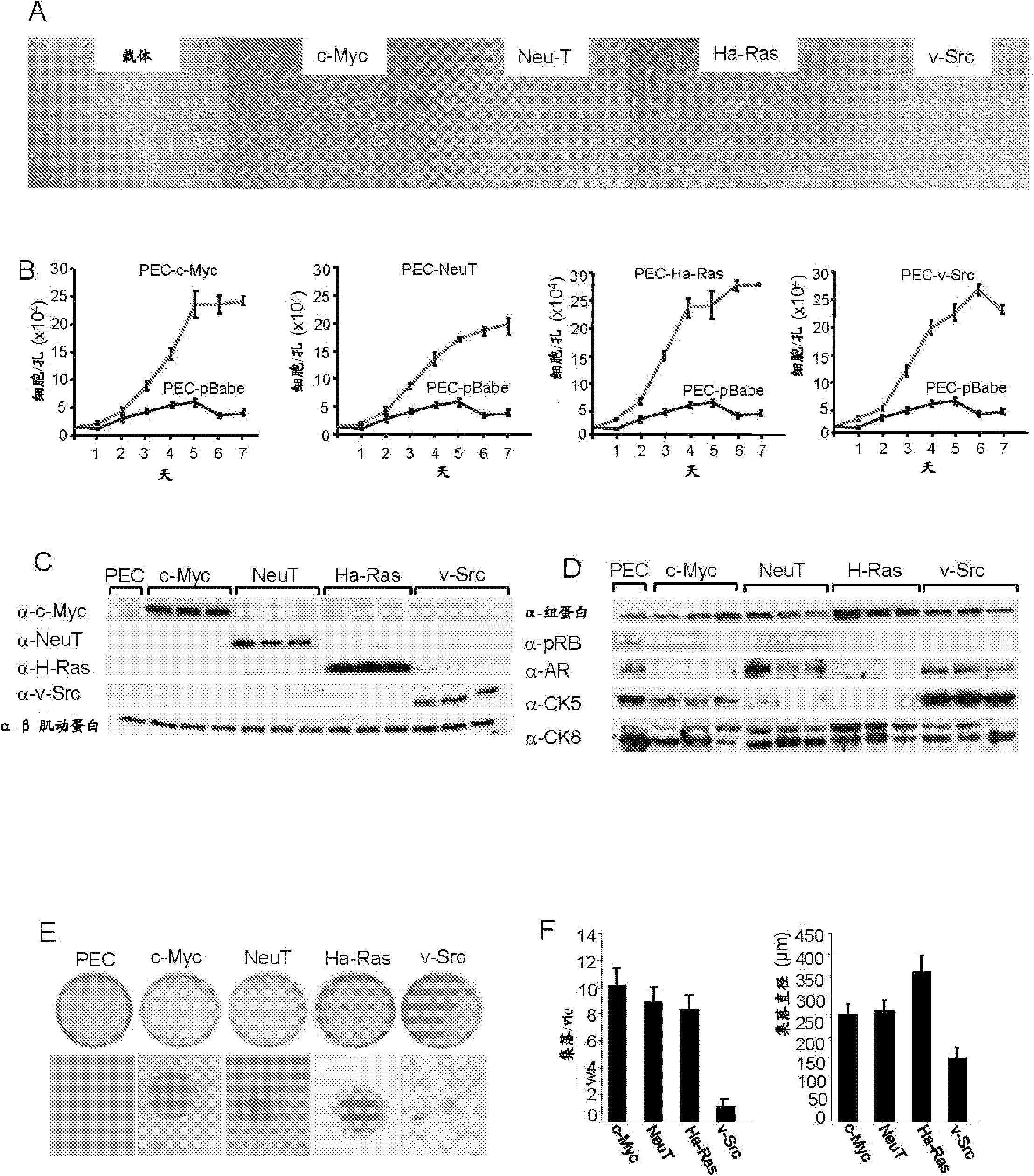 Prostate cancer cell line, gene signatures and uses thereof