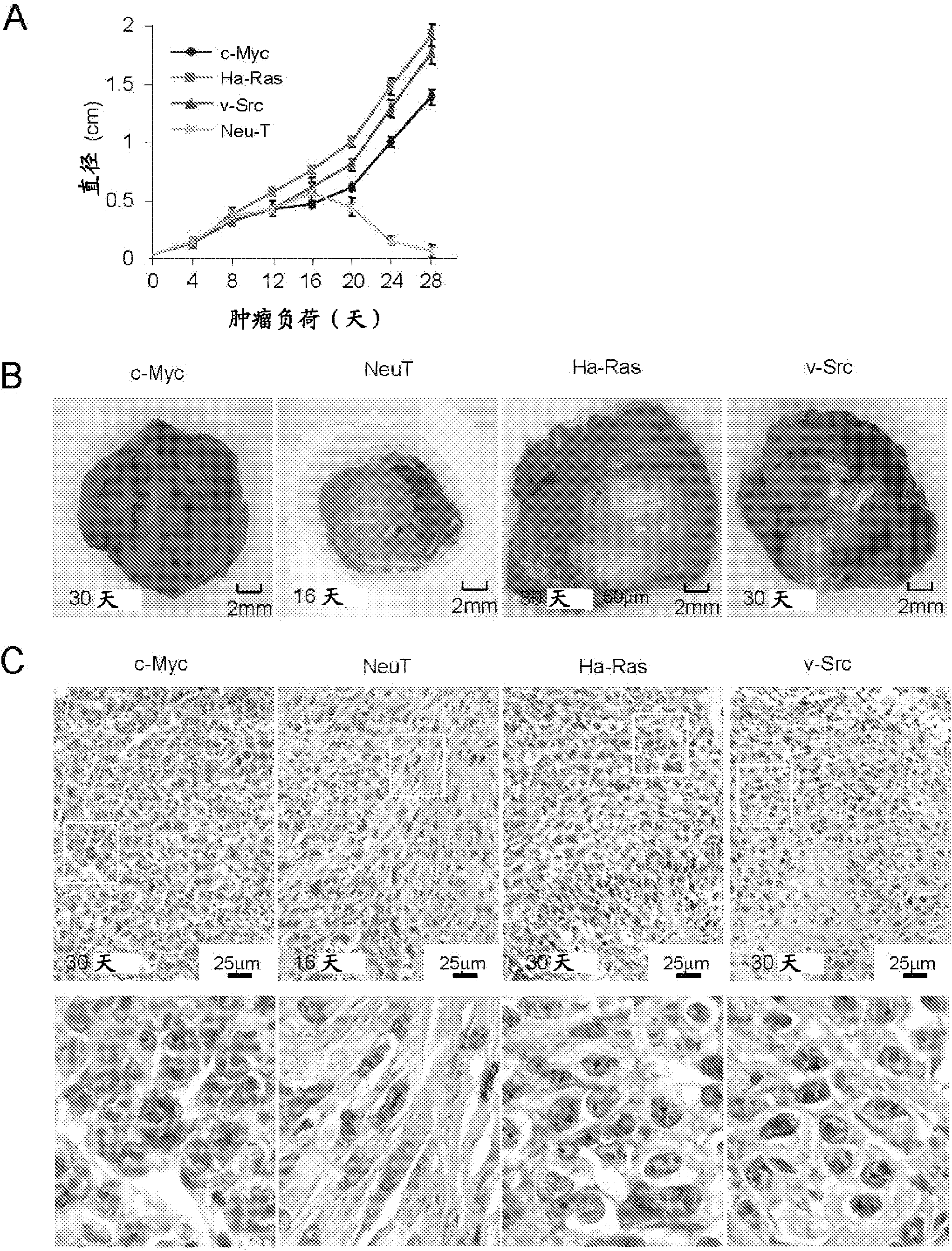 Prostate cancer cell line, gene signatures and uses thereof