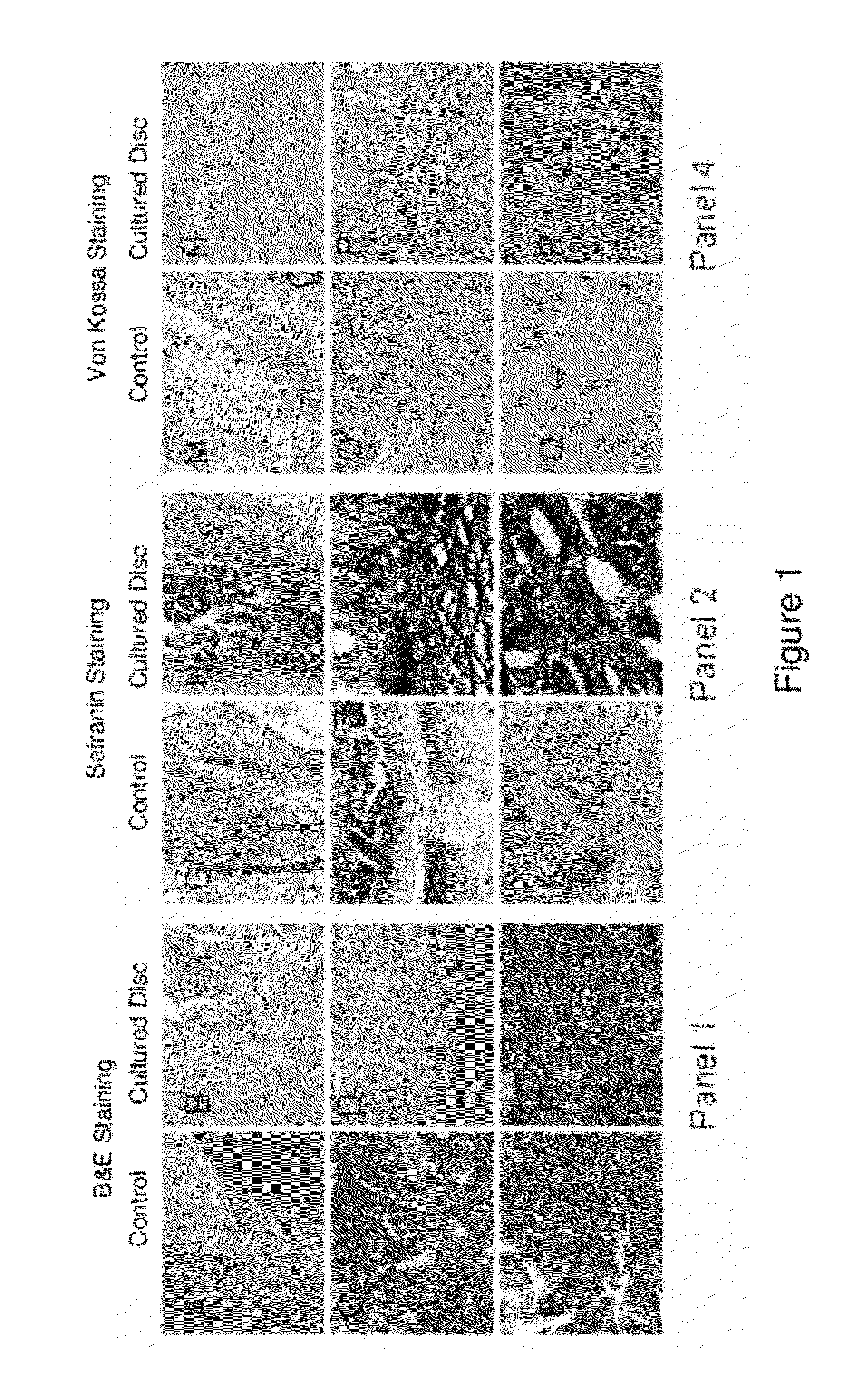 Compositions of adult disc stem cells and methods for the treatment of degenerative disc disease