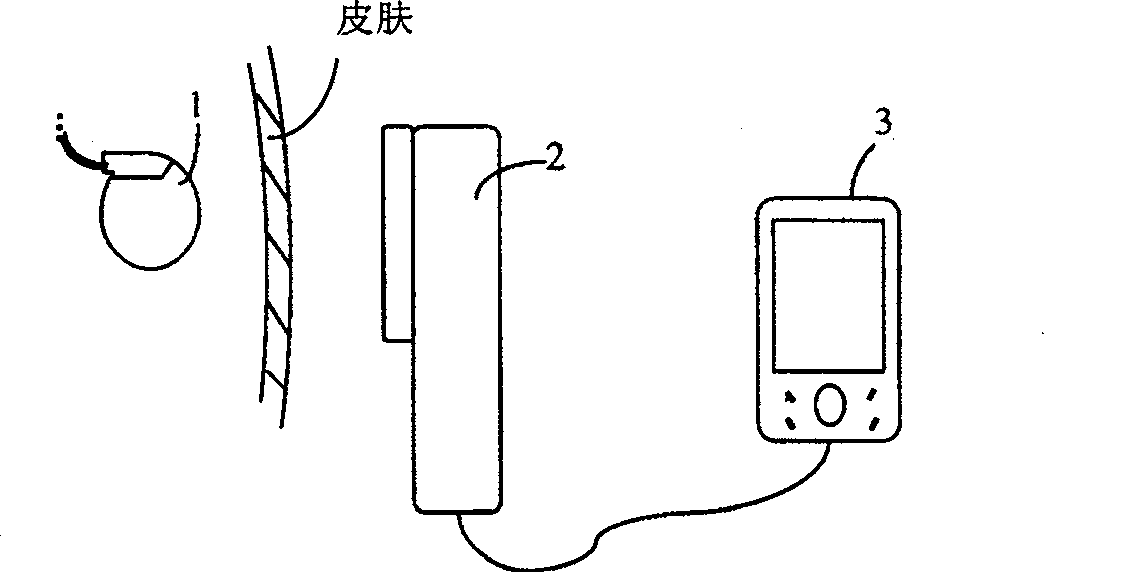 Two-way radio communication device for implanting type medical instrument