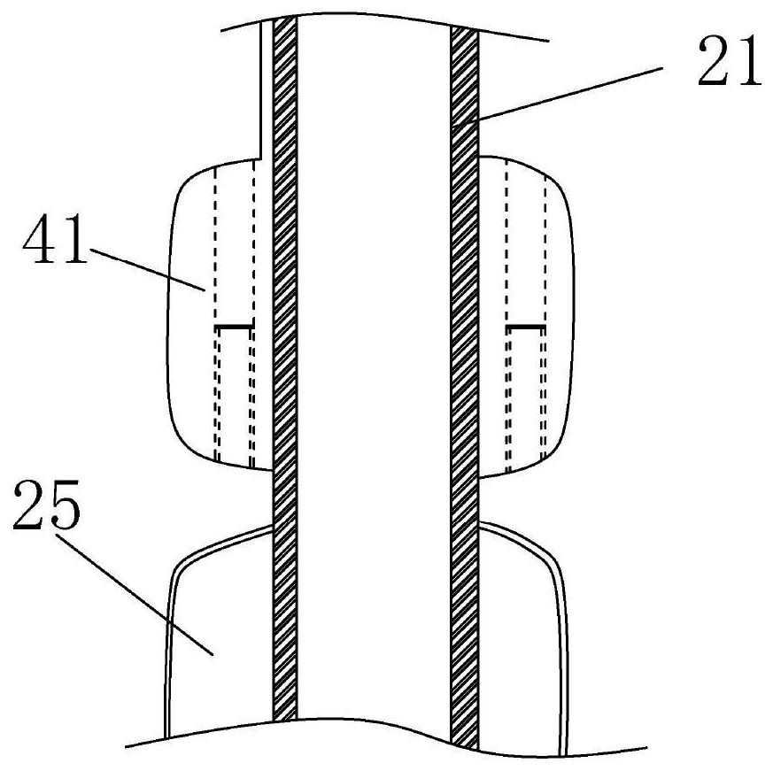 Voice training rehabilitation device used after tracheotomy