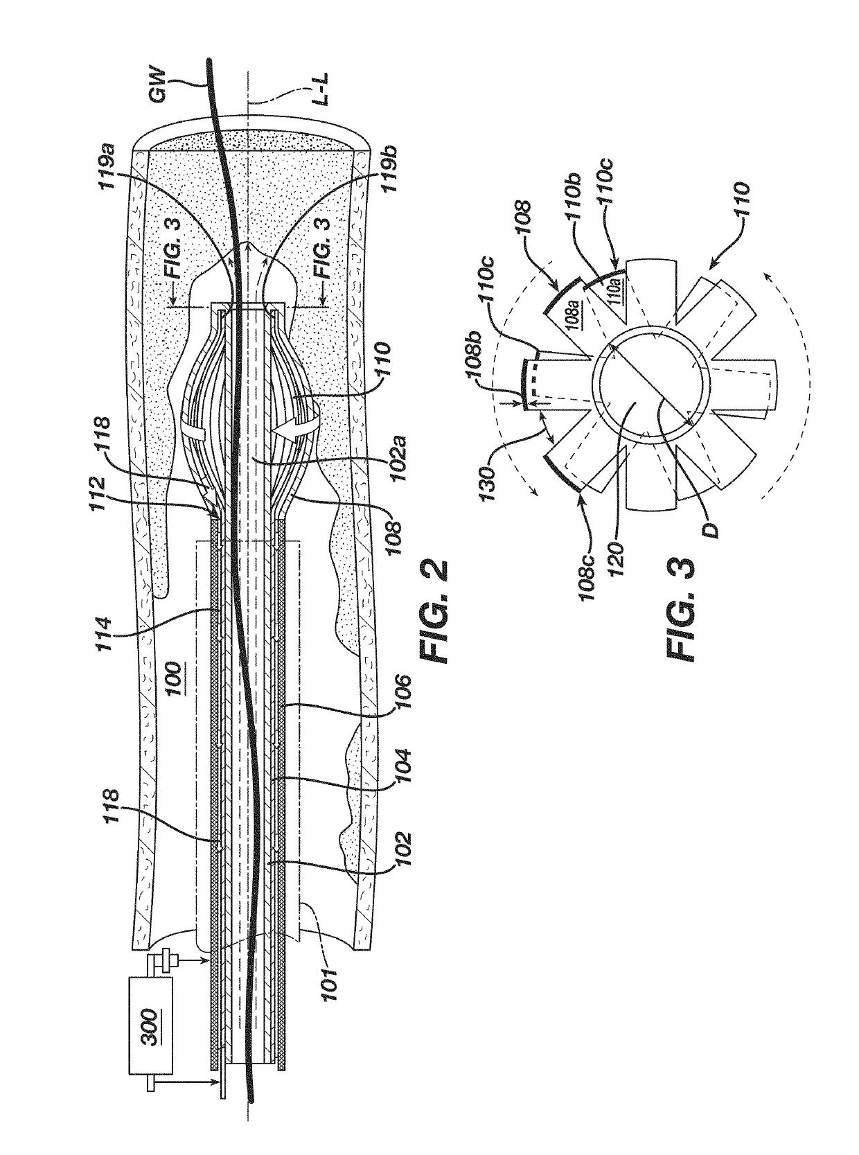 Dual-basket self-centering rotational device for treatment of arterial occlusive disease with infinitely adjustable cutting size