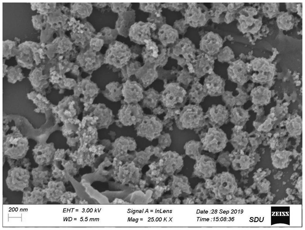 Preparation method of long-circulation multifunctional metal organic framework nano preparation