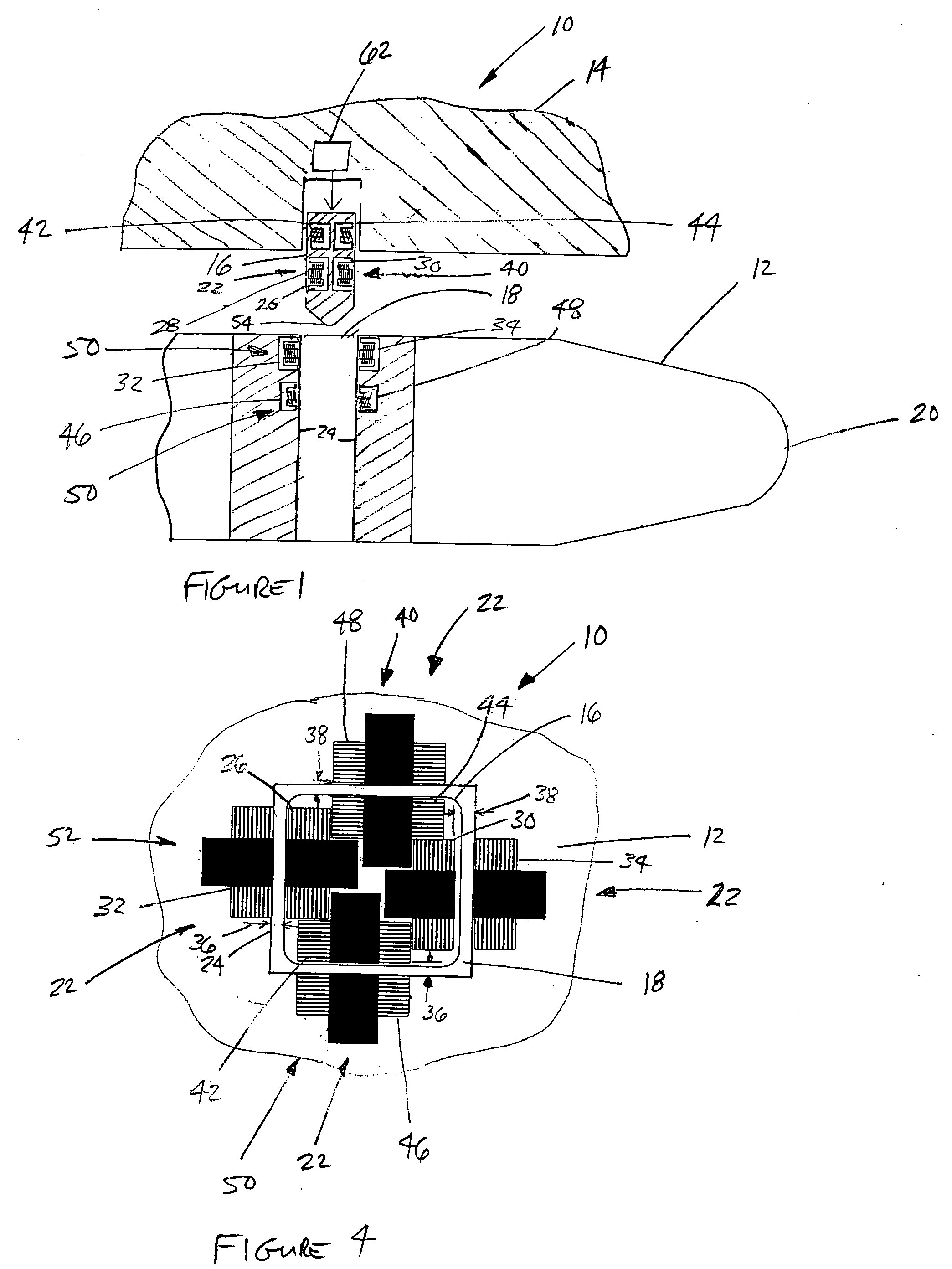 Inductive power transfer system for underwater applications