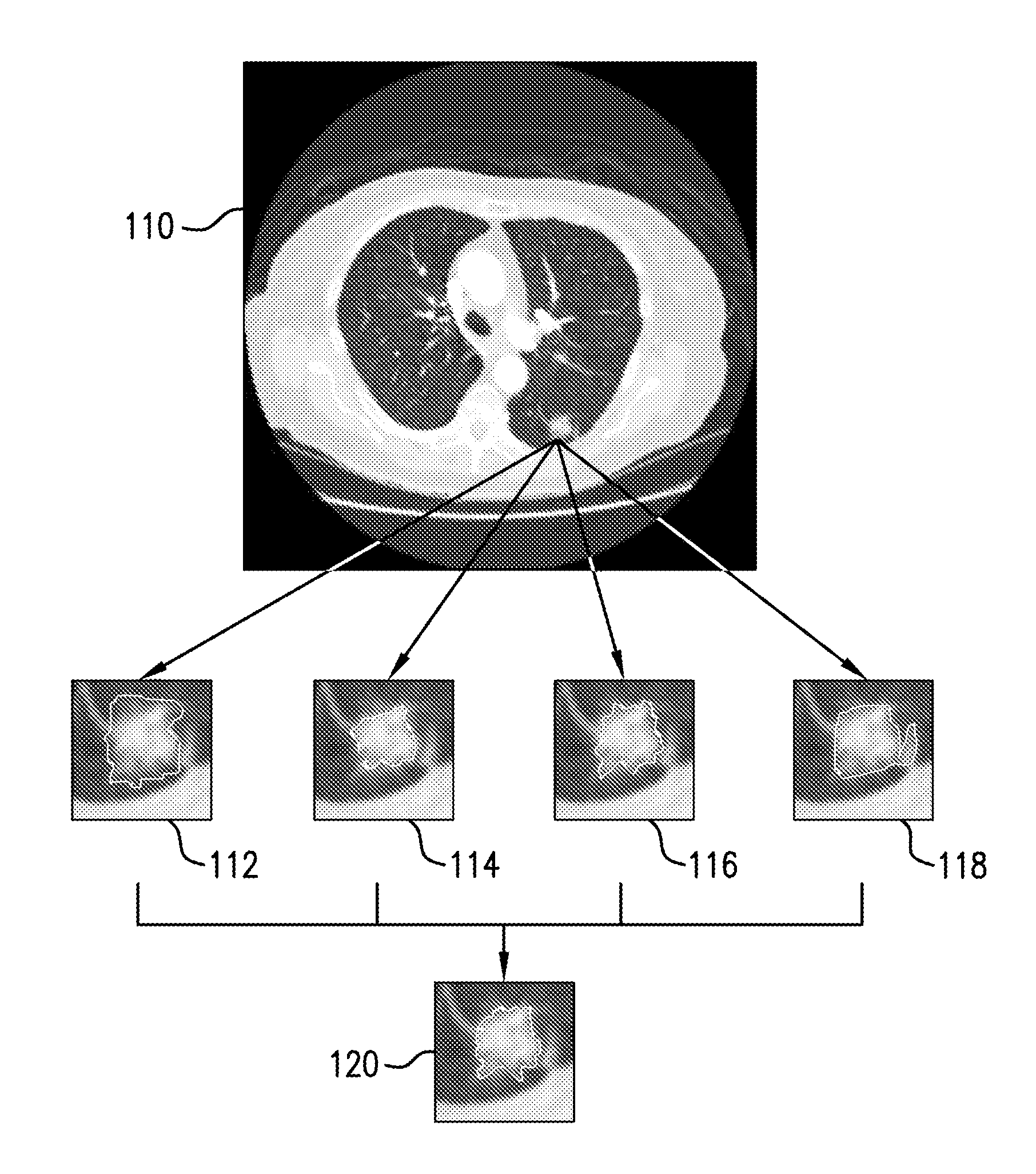 Method for adaptive computer-aided detection of pulmonary nodules in thoracic computed tomography images using hierarchical vector quantization and apparatus for same