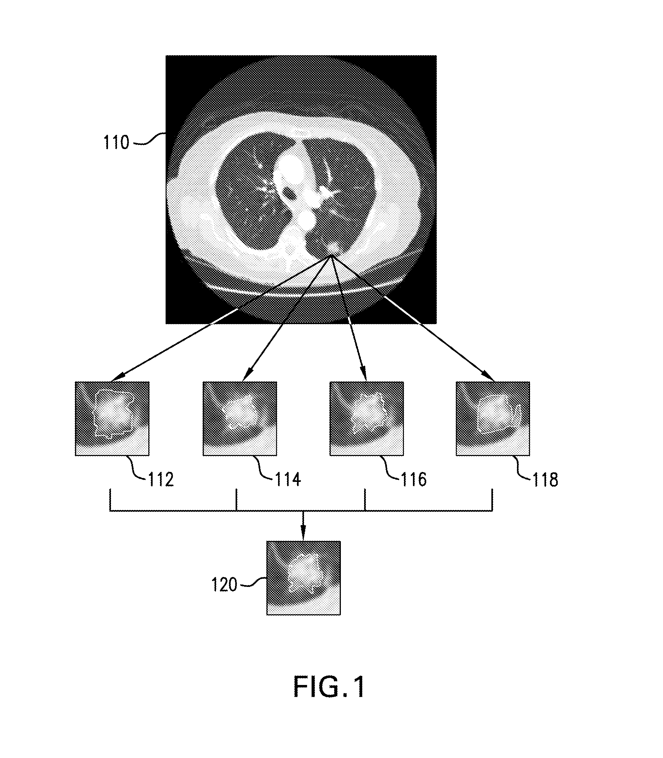 Method for adaptive computer-aided detection of pulmonary nodules in thoracic computed tomography images using hierarchical vector quantization and apparatus for same