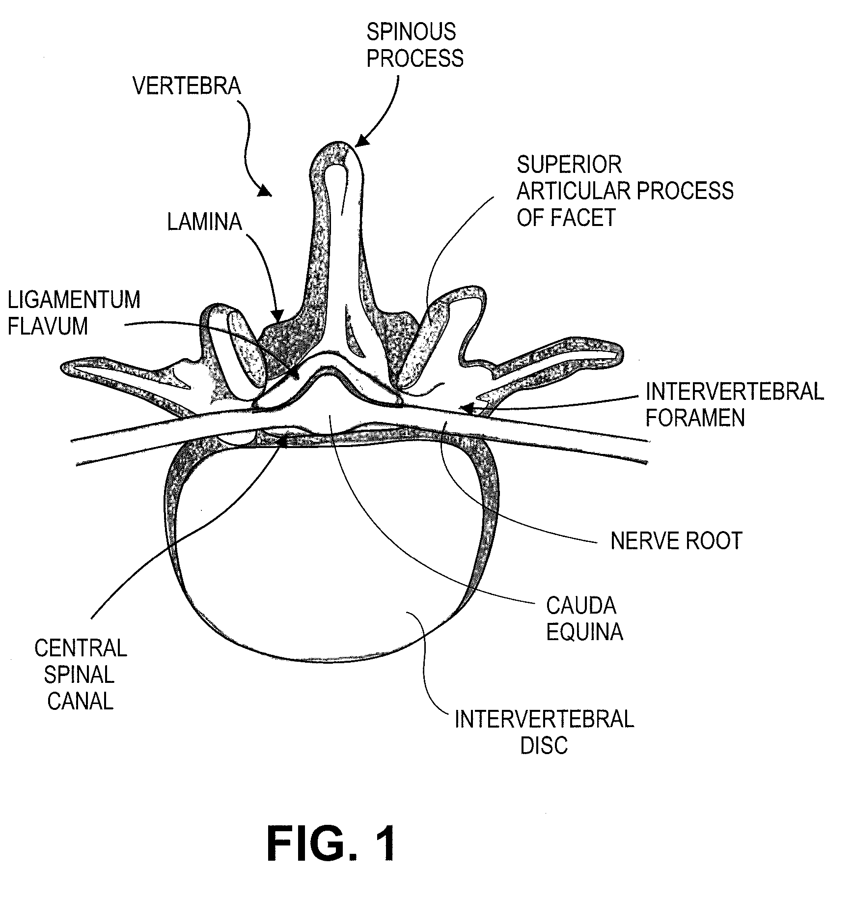 Surgical probe and method of making