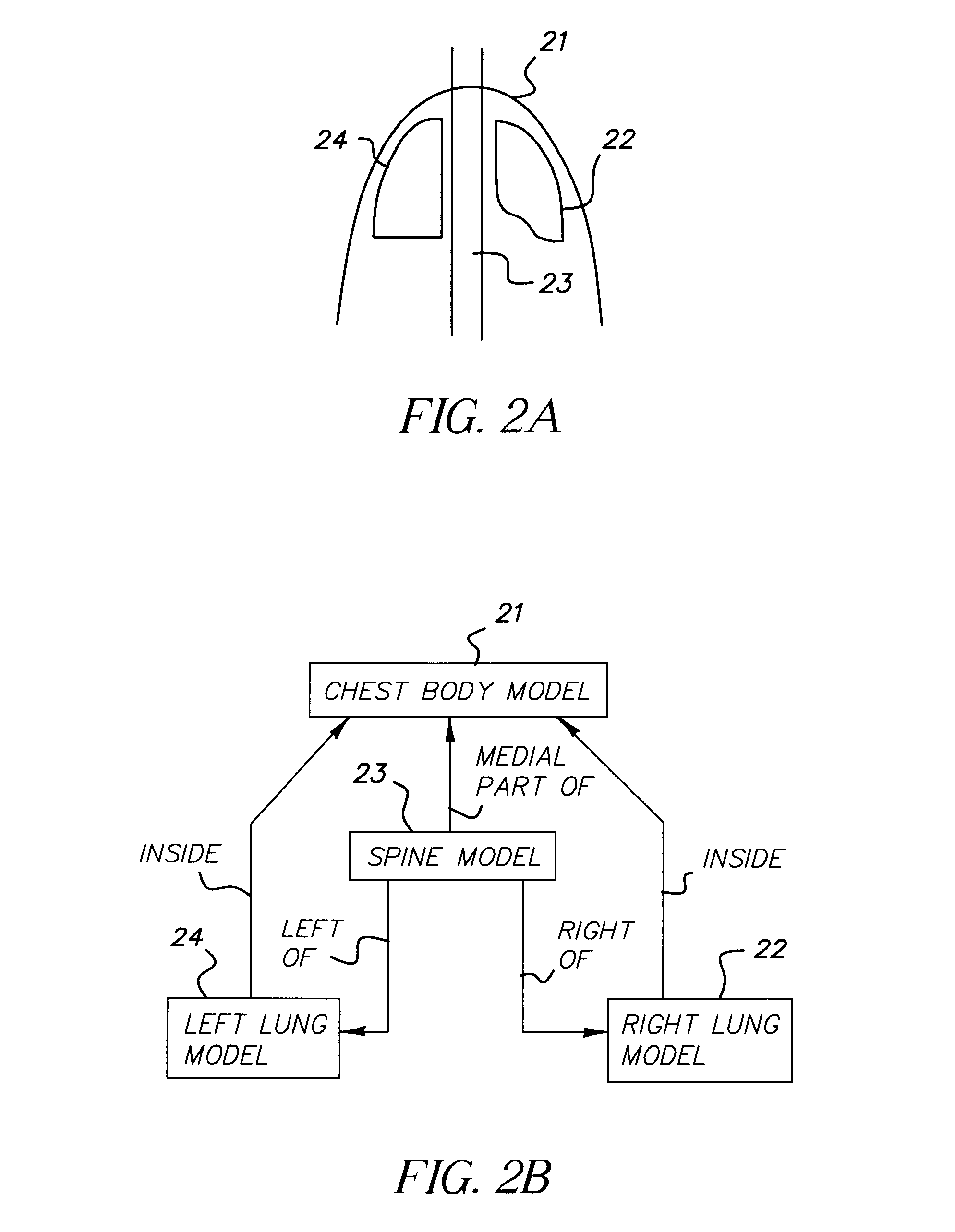 Method for automated analysis of digital chest radiographs