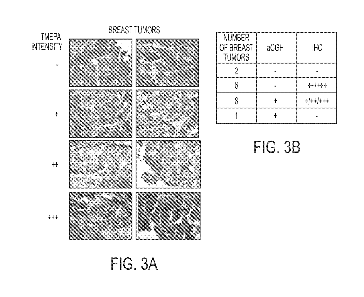 Methods for classifying a cancer as susceptible to TMEPAI-directed therapies and treating such cancers