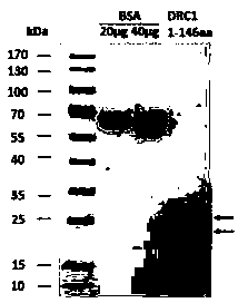 Preparation method of polyclonal antibody for specific recognition of dynein regulatory complex protein 1(DRC1) and application of preparation method