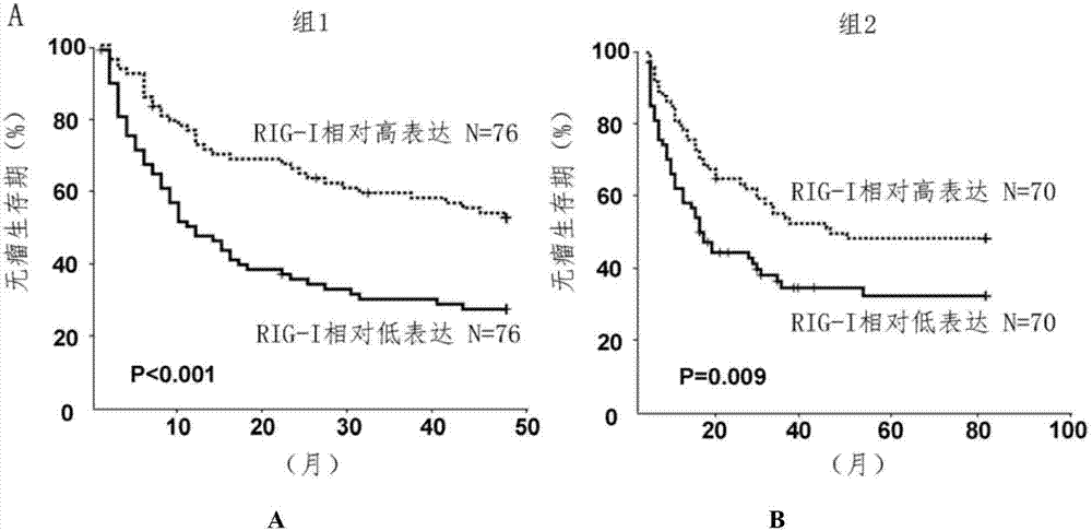 Application of pattern recognition receptor RIG-I in preparing kit for tumor diagnosis or prognosis evaluation