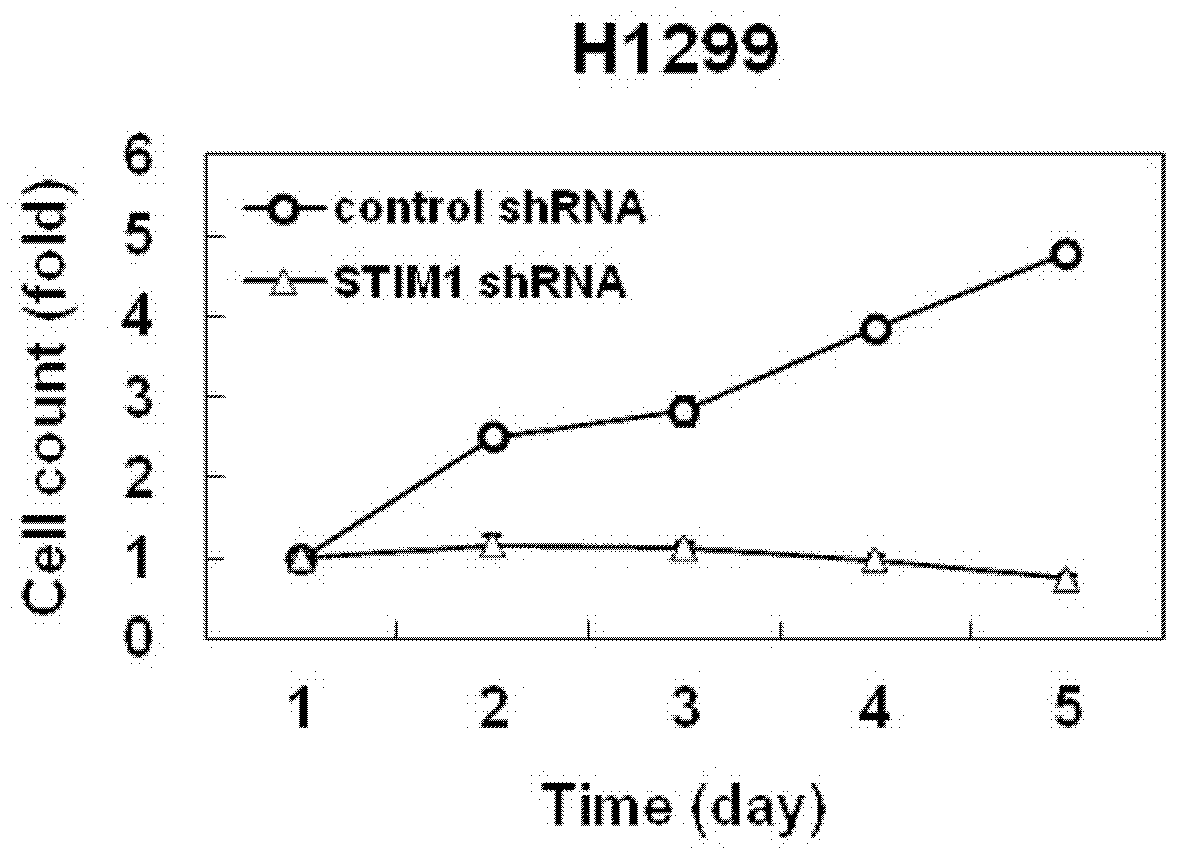 Applications and correlated medicament of human STIM1 gene
