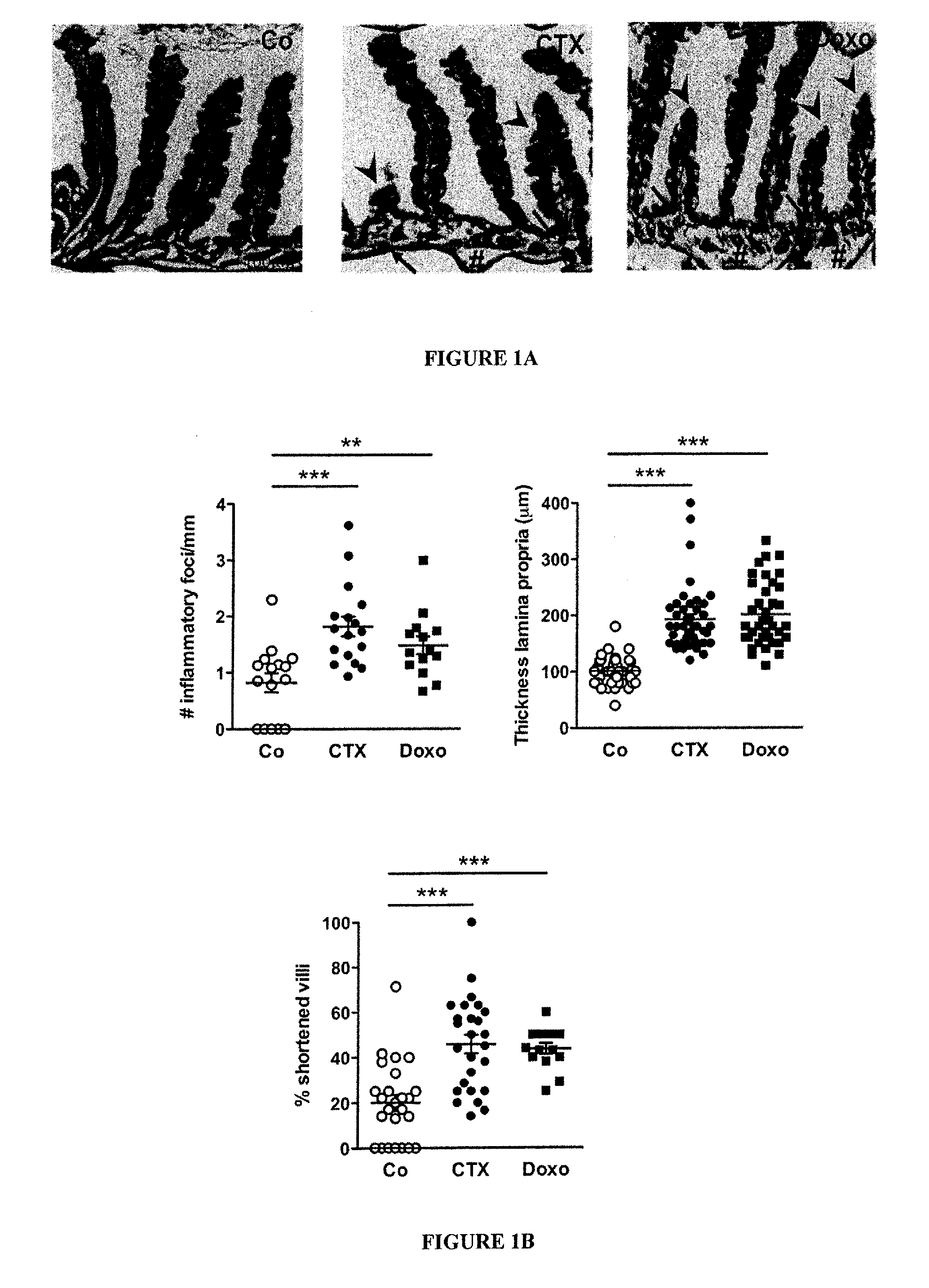 Microbiota composition, as a marker of responsiveness to chemotherapy, and use of microbial modulators (pre-, pro- or synbiotics) for improving the efficacy of a cancer treatment