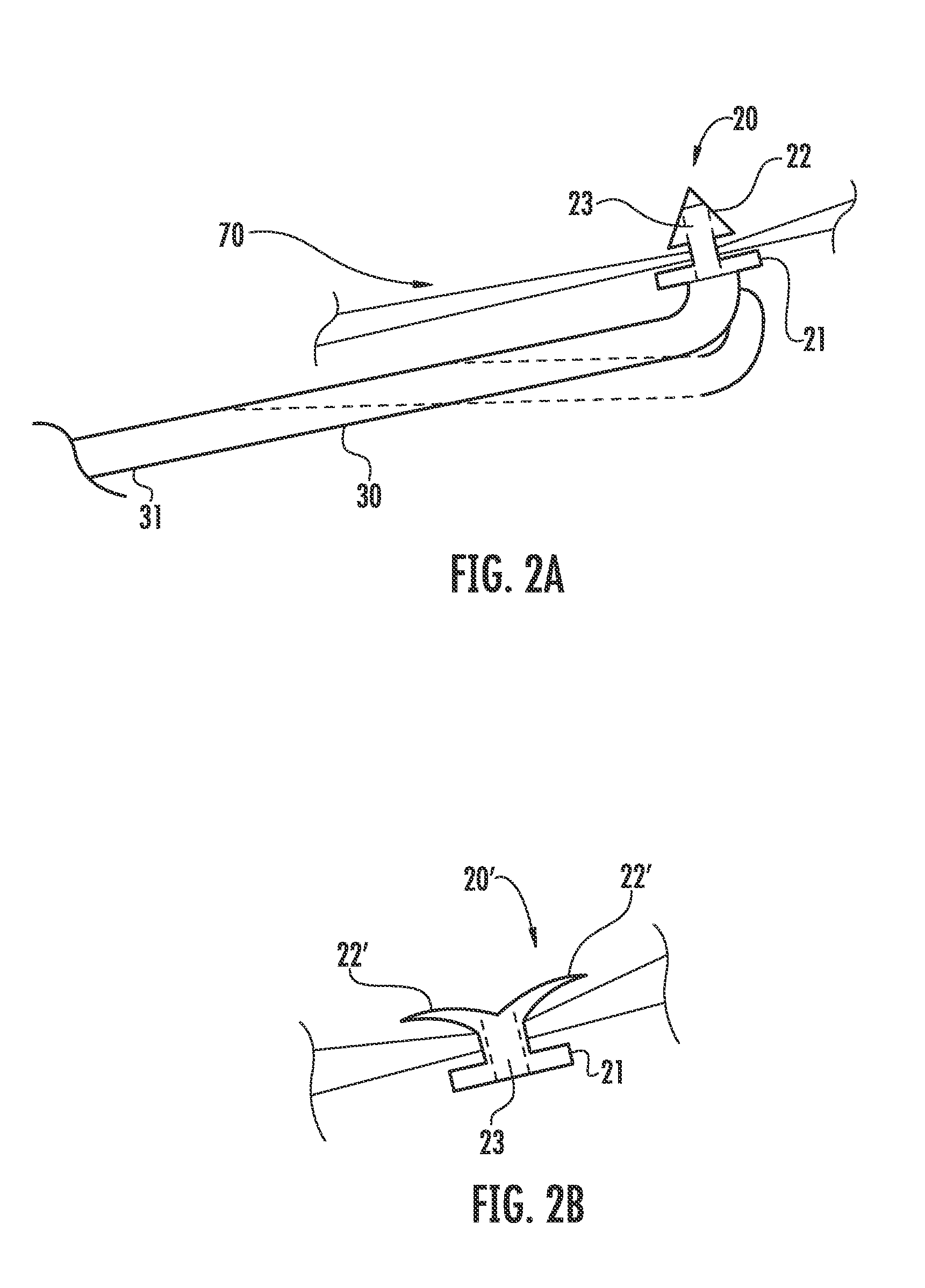 Nasal ventilation system and method of using same