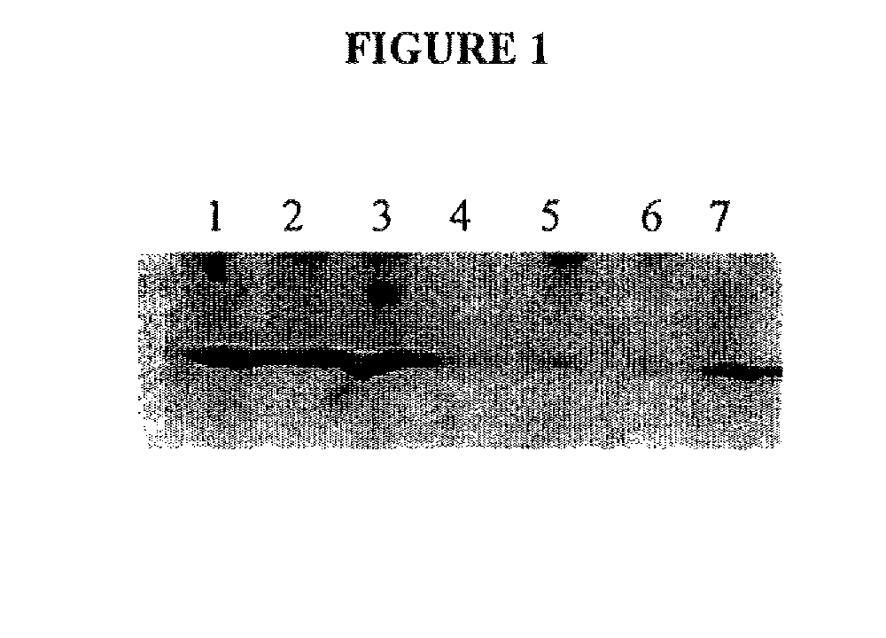 Compositions and Methods for Inhibiting an Isoform of Human Manganese Superoxide Dismutase
