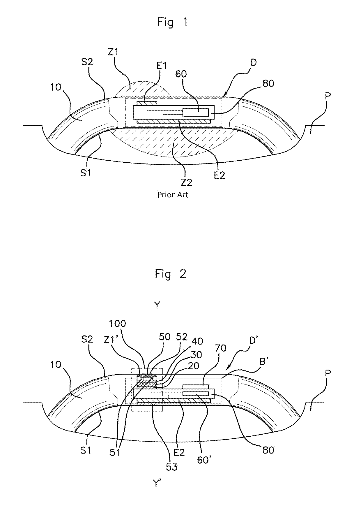 Device for detecting a user's intention to lock or unlock a motor vehicle door