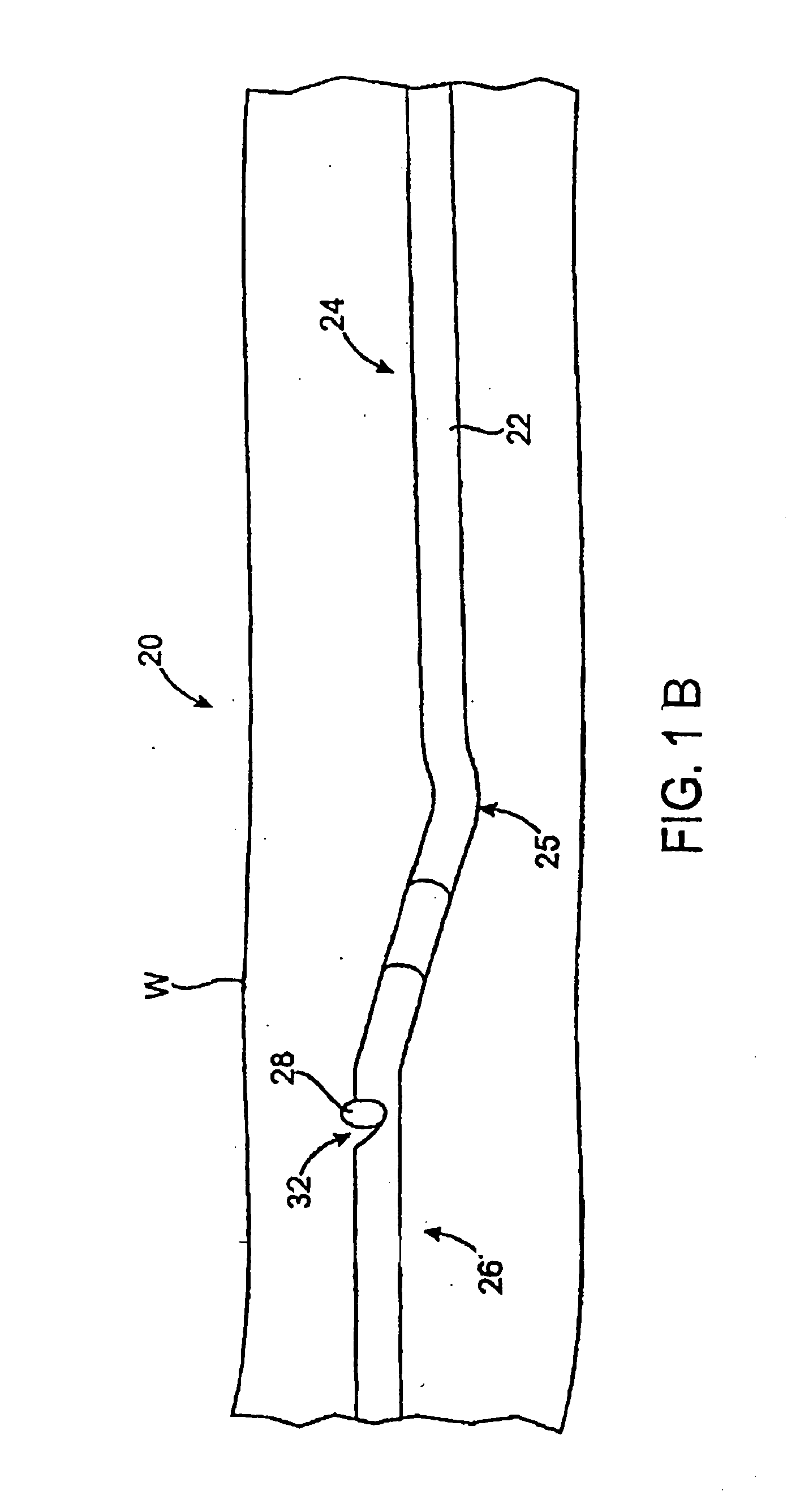 Method of evaluating a treatment for vascular disease