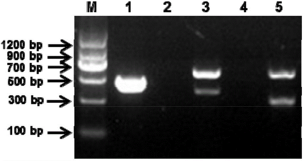 Kit for detecting Newcastle disease viruses of chicken with different genotypes