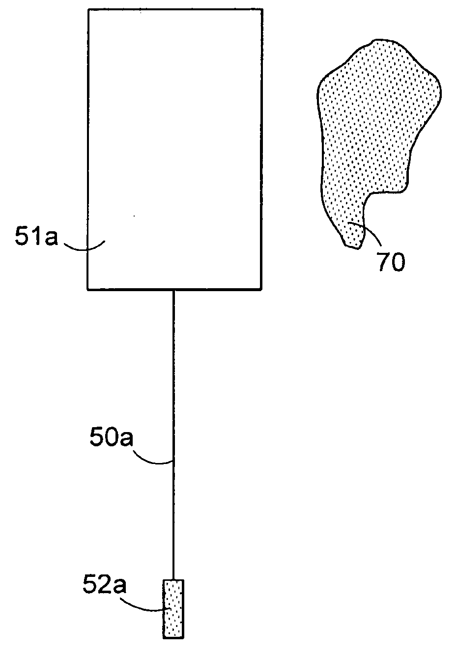 Method and apparatus for treating or preventing a medical condition