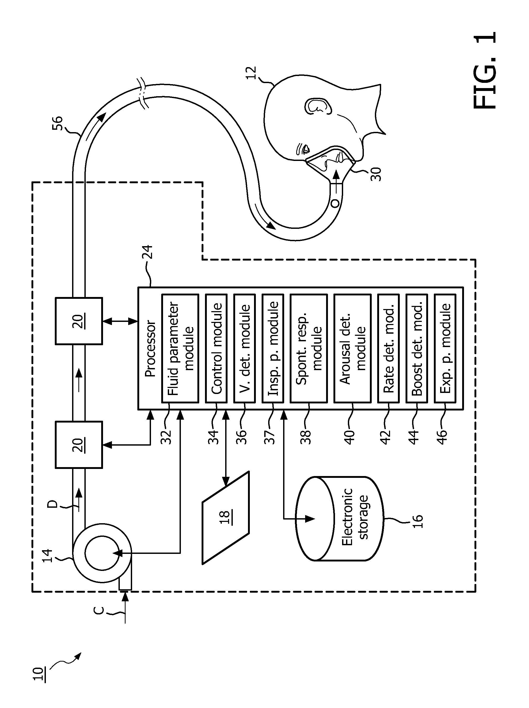 Obesity hypventilation syndrome treatment system and method