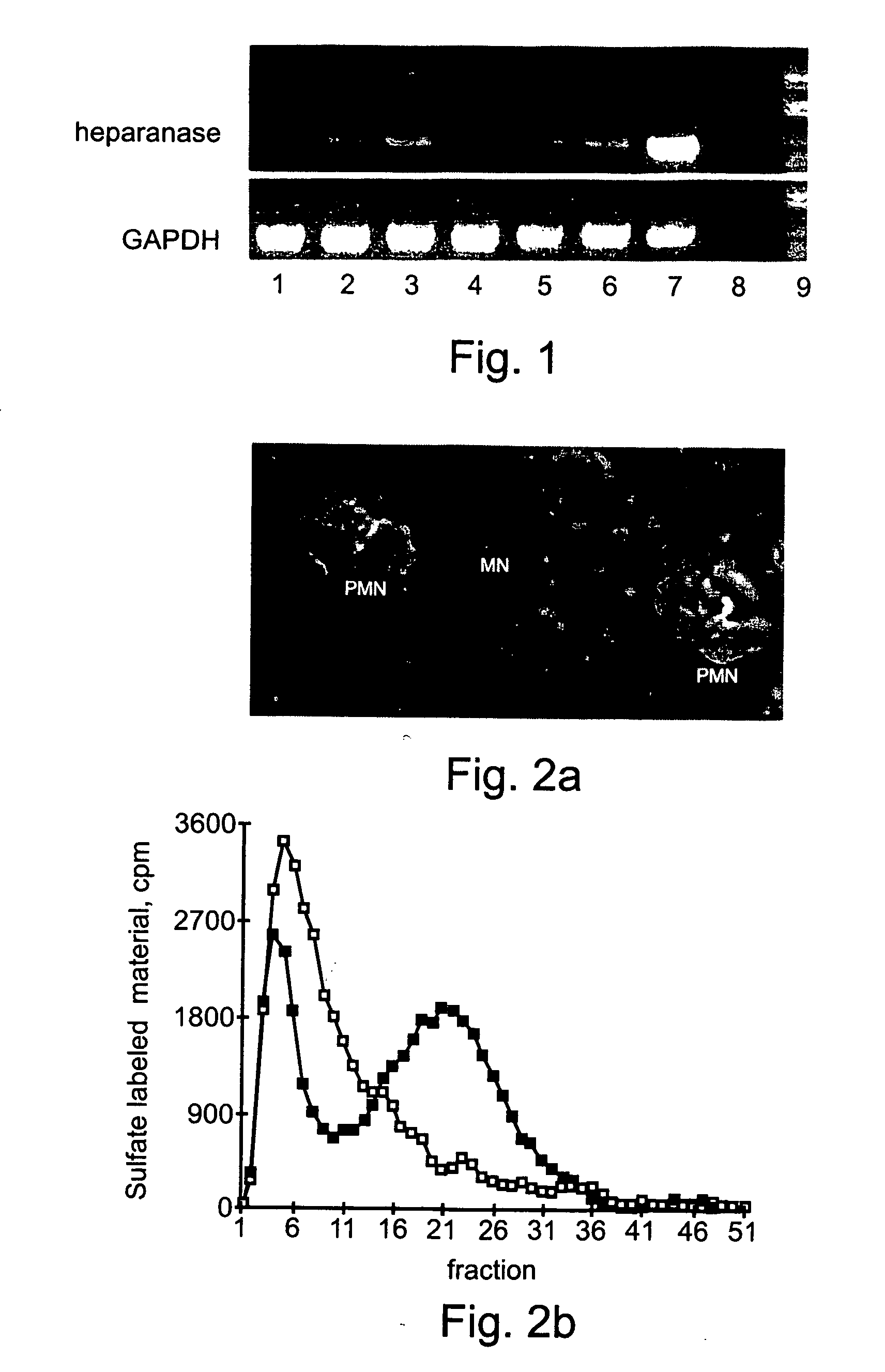 Methods and kits for diagnosing and monitoring hematopoietic cancers