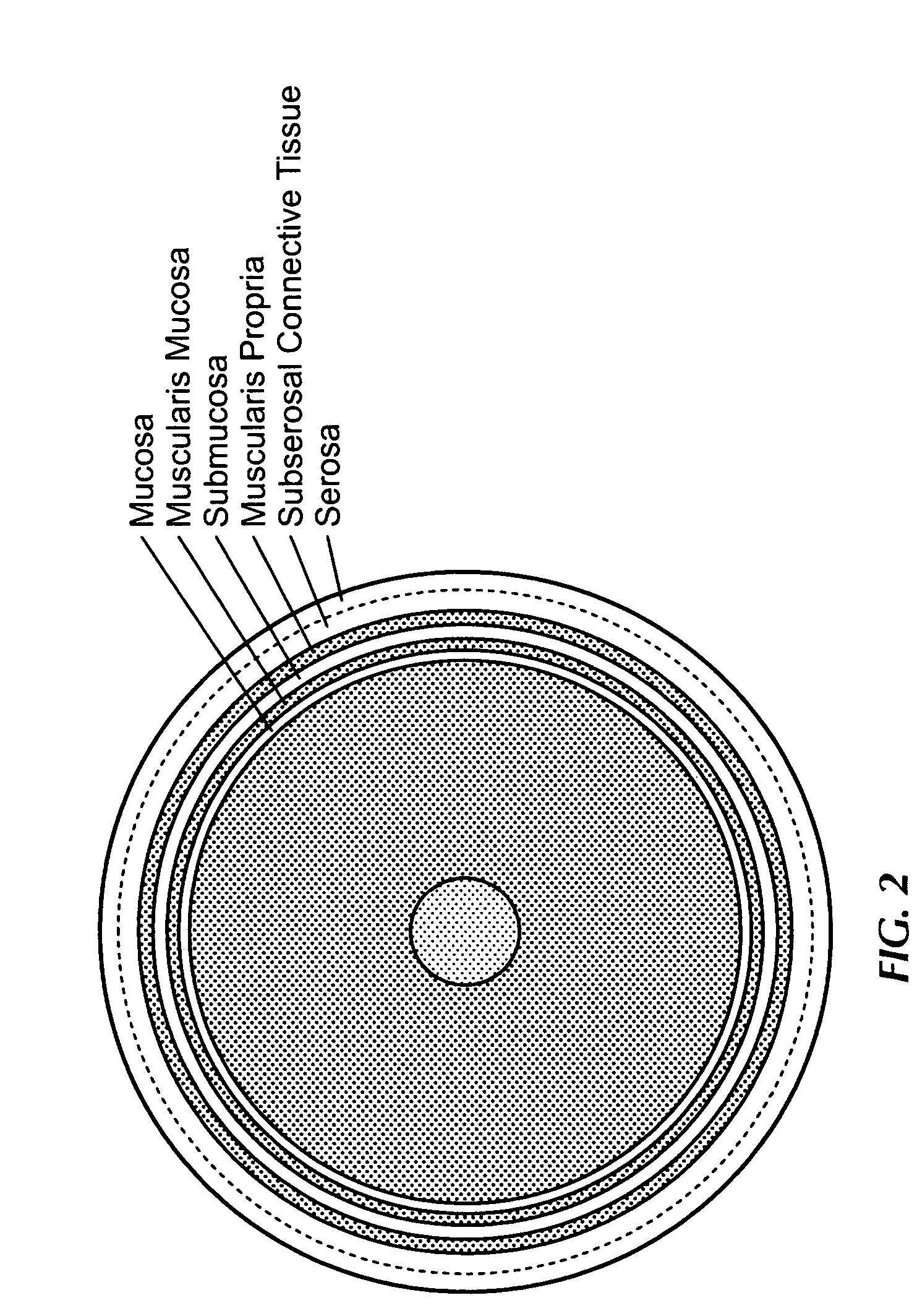 Method and apparatus for calibration, tracking and volume construction data for use in image-guided procedures