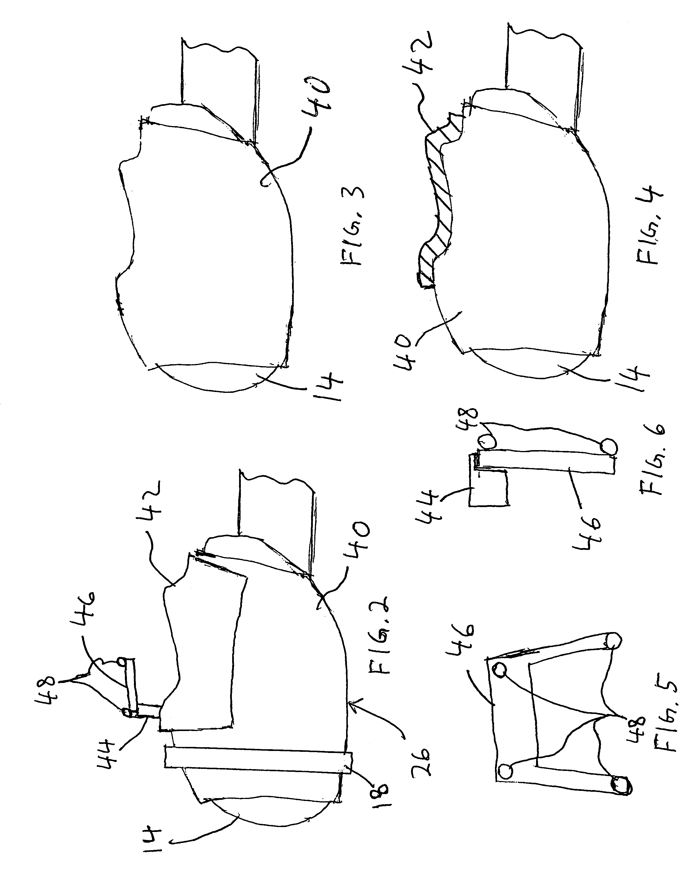 Mask system and method for stereotactic radiotherapy and image guided procedures