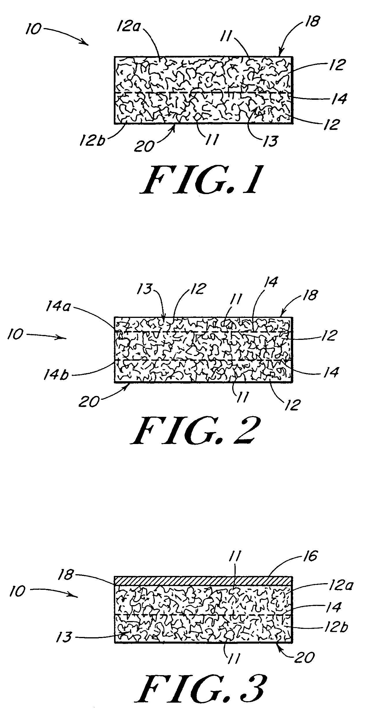 Reinforced foam implants with enhanced integrity for soft tissue repair and regeneration