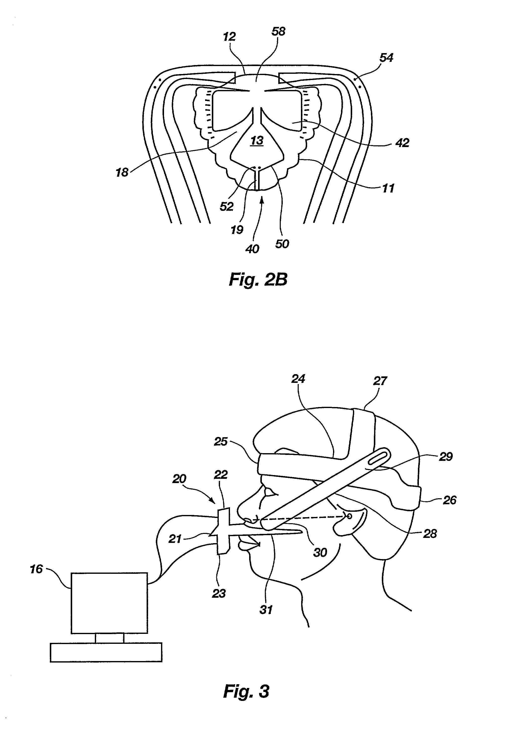 Palatometer and nasometer apparatus