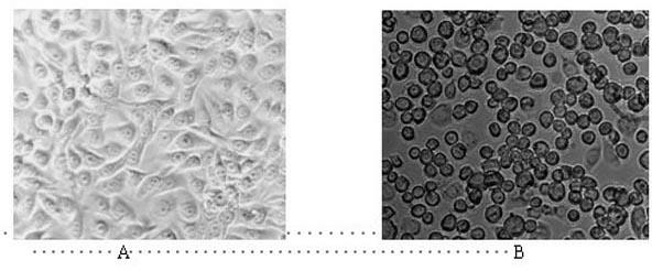 Preparation method of orally-taken vaccine for treatment of hemorrhage of grass carp