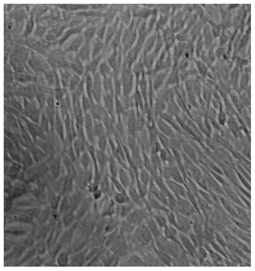 Fusion gene for modifying mesenchymal stem cells, plasmid, stem cells obtained through modification and preparation method
