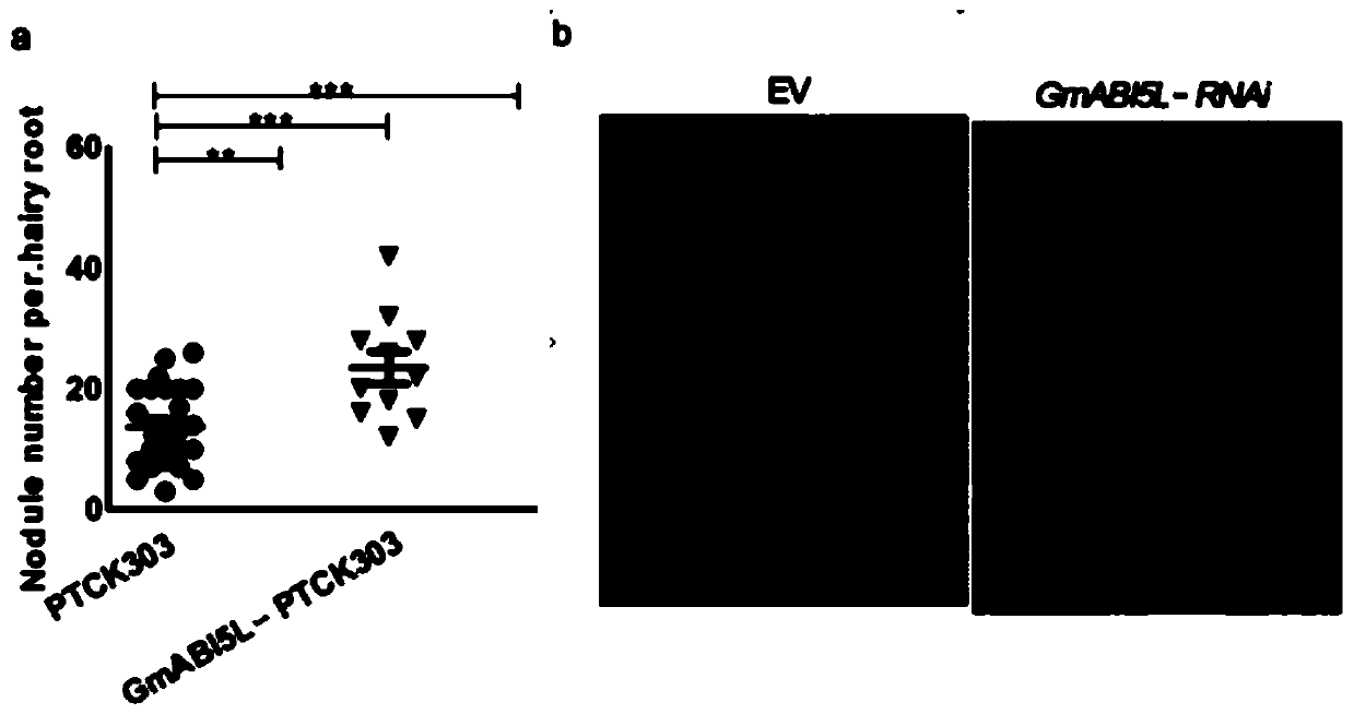 Method for cultivating highly noduled transgenic plants based on RNA interference technology