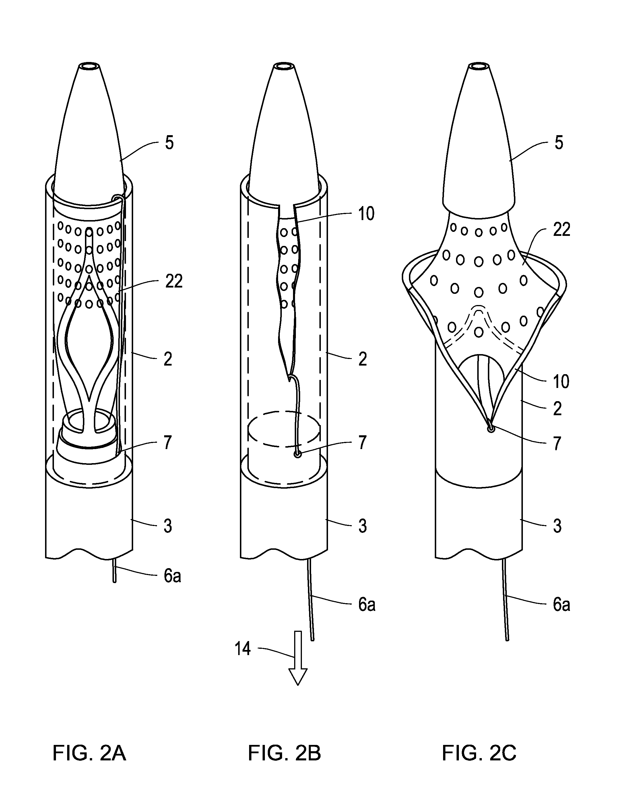 Delivery catheter with constraining sheath and methods of deploying medical devices into a body lumen
