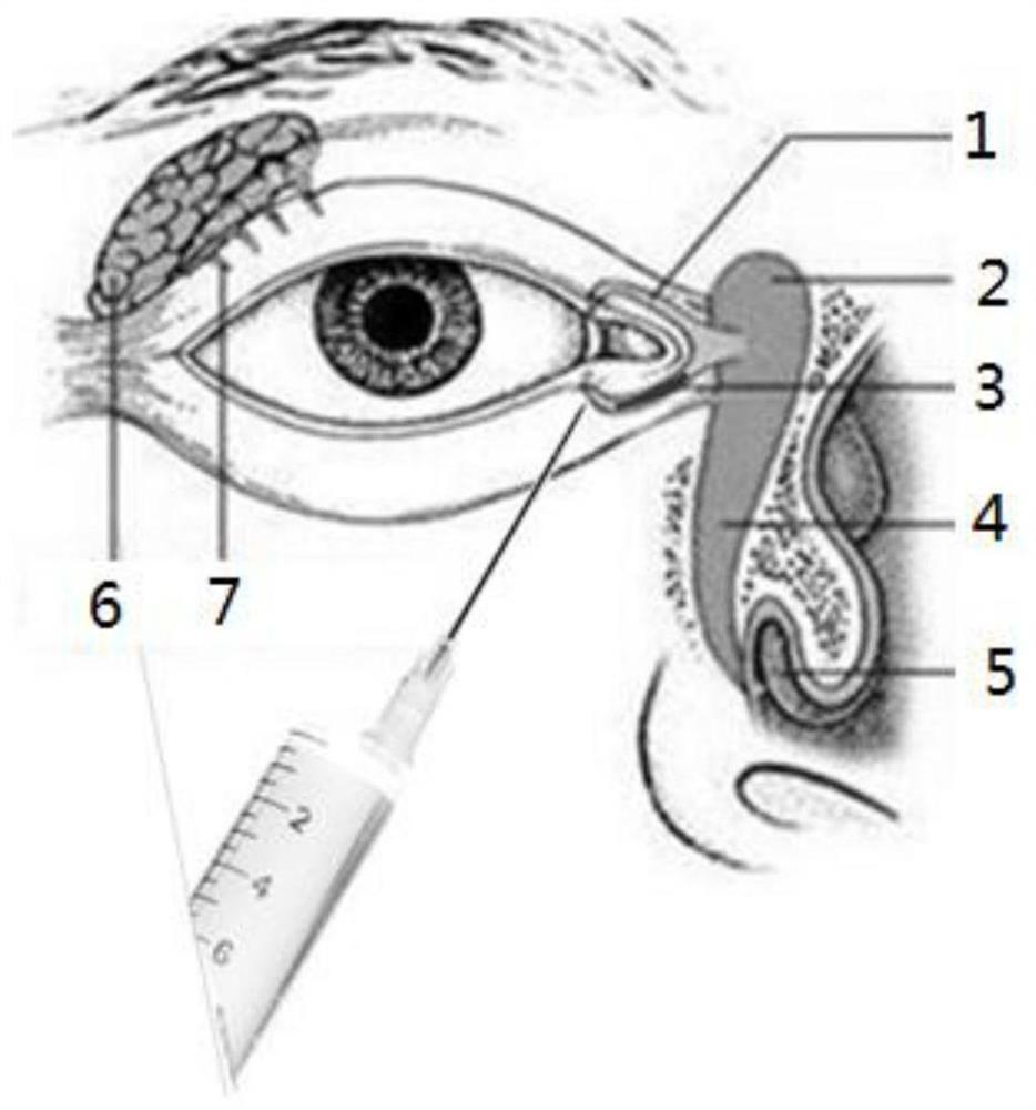 A temperature-sensitive injectable lacrimal plug and its preparation method