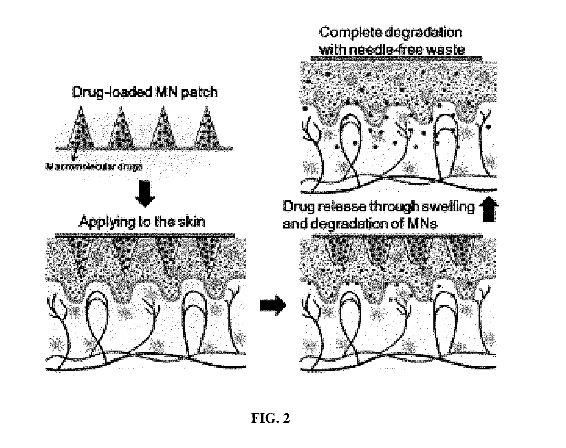 Biodegradable microdepot delivery system for topical delivery