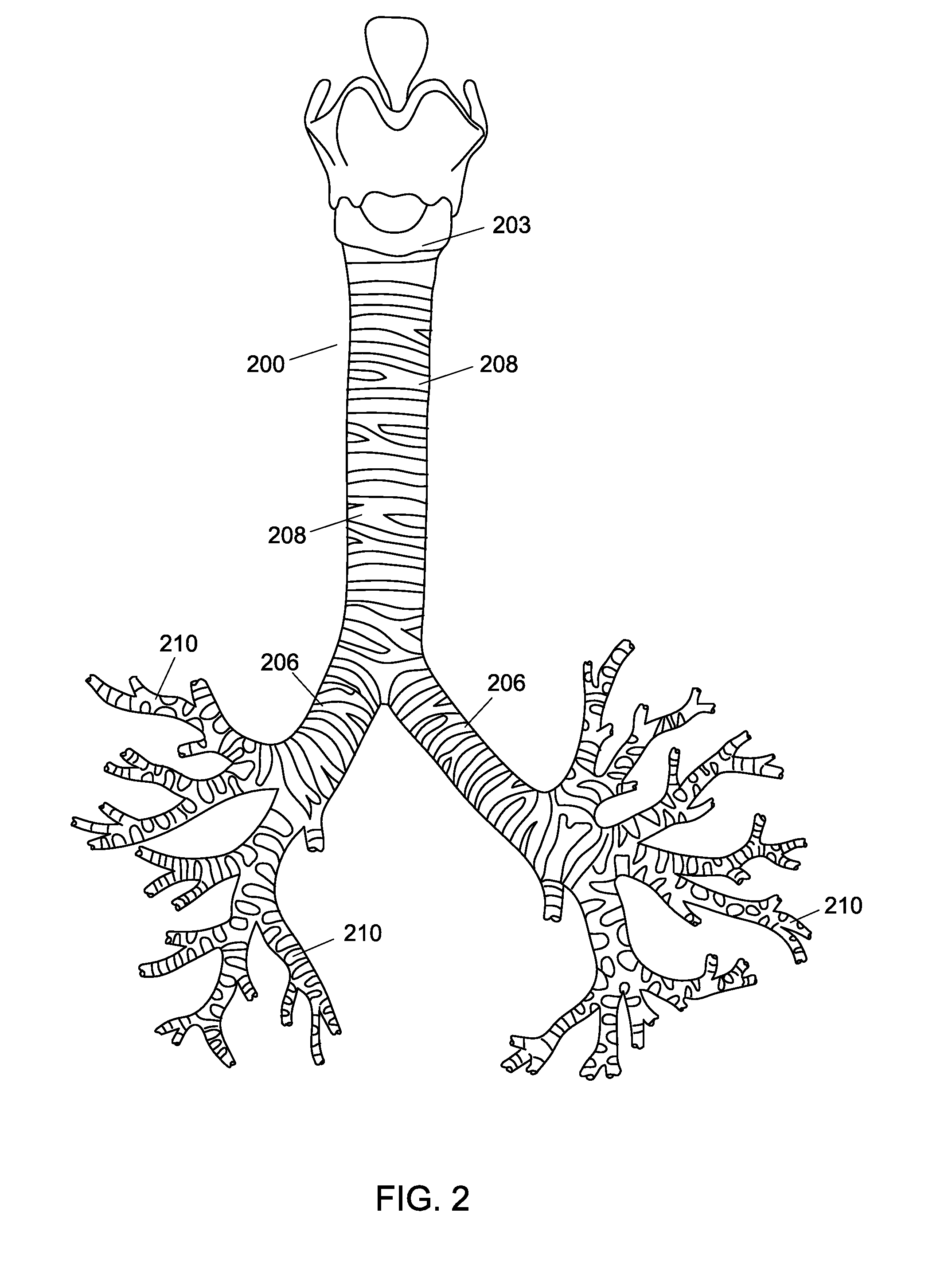 System and method for fabricating custom medical implant devices